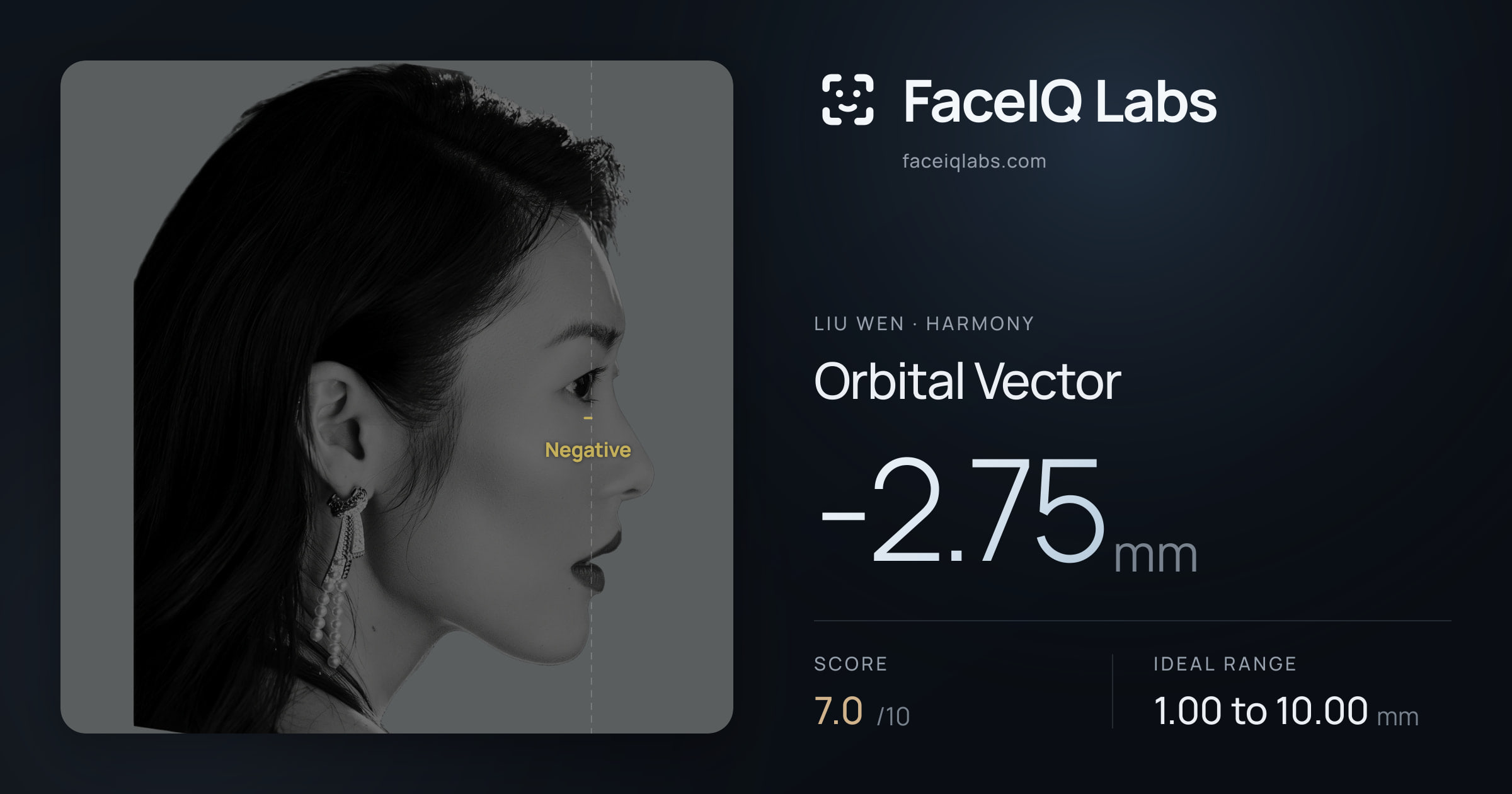 Liu Wen Orbital Vector: -2.75mm, drawn on the photo