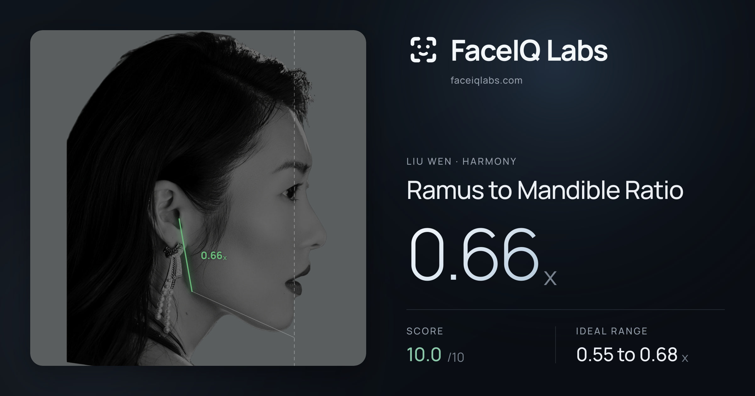 Liu Wen Ramus to Mandible Ratio: 0.66x, drawn on the photo