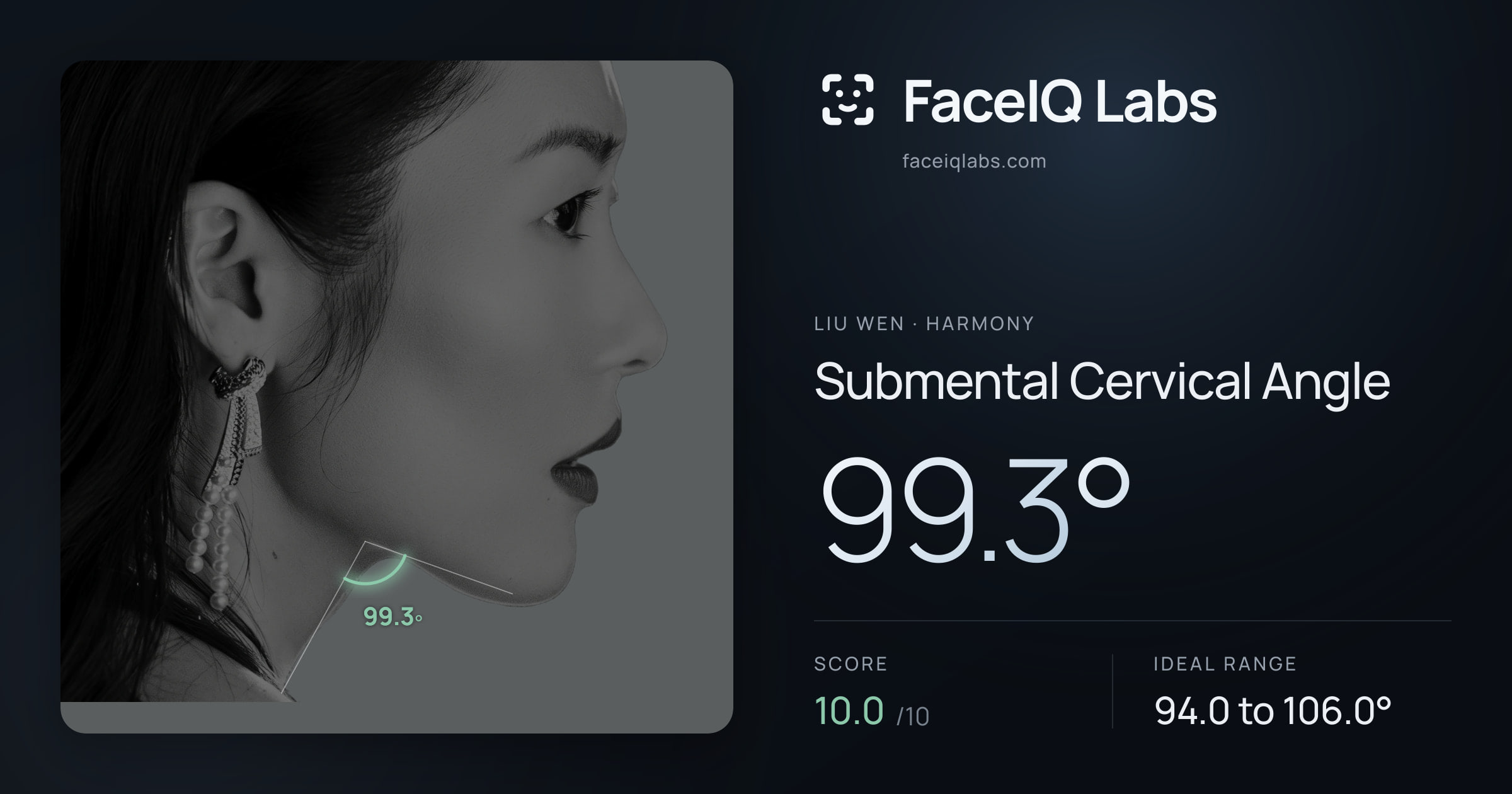 Liu Wen Submental Cervical Angle: 99.3°, drawn on the photo