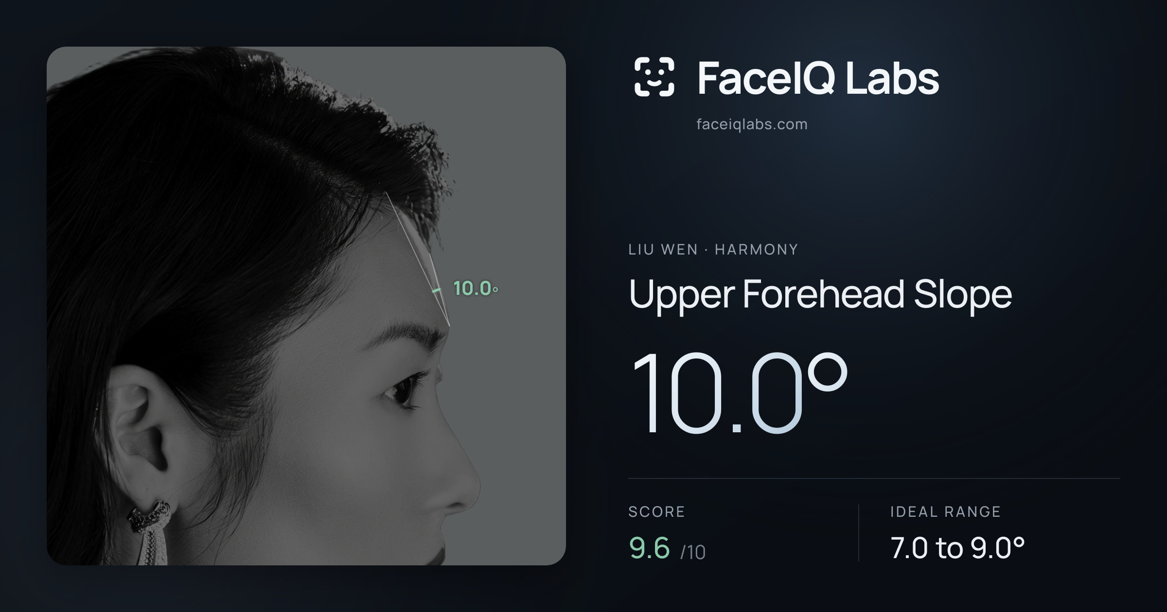 Liu Wen Upper Forehead Slope: 10.0°, drawn on the photo