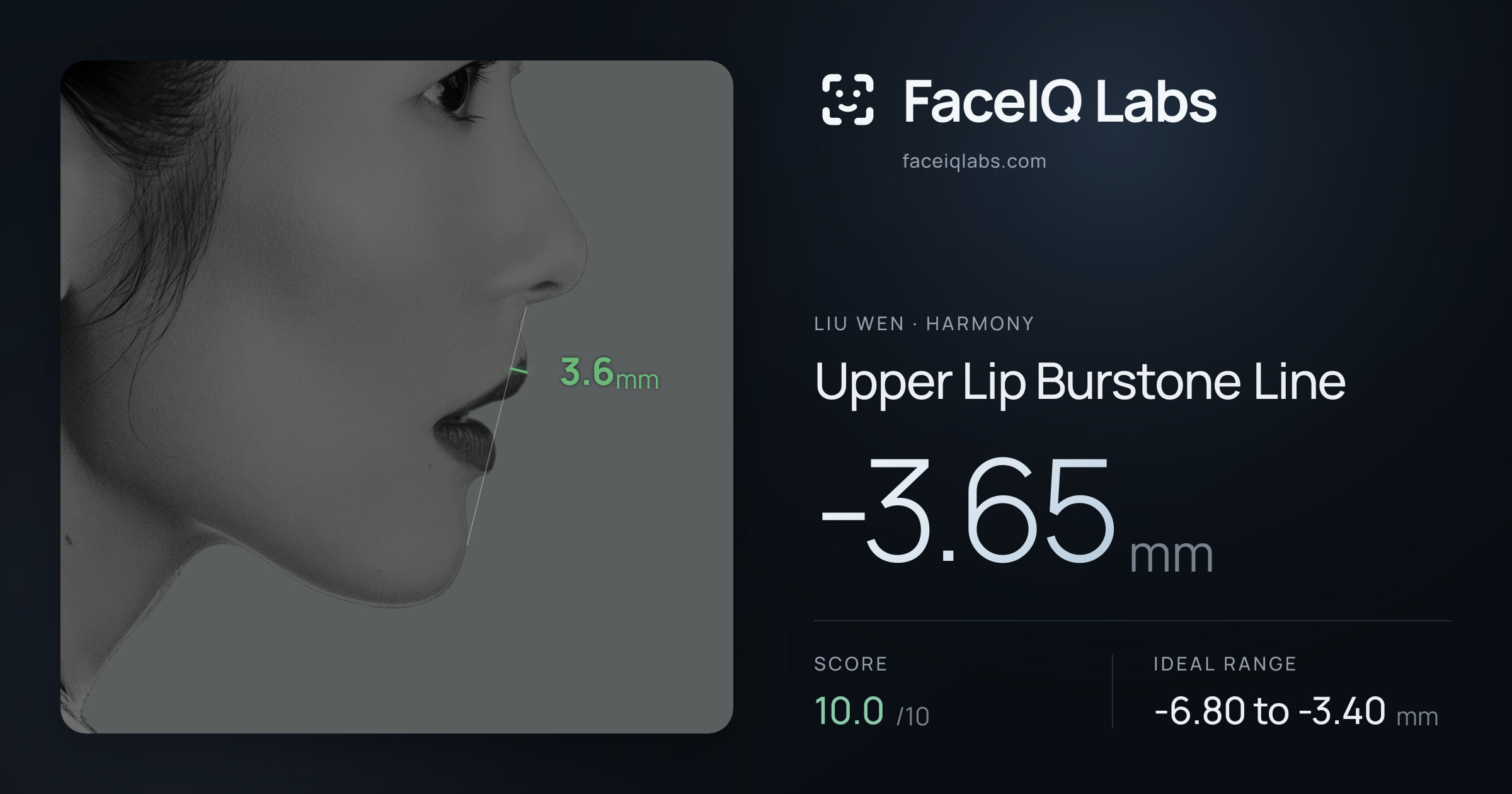 Liu Wen Upper Lip Burstone Line: -3.65mm, drawn on the photo