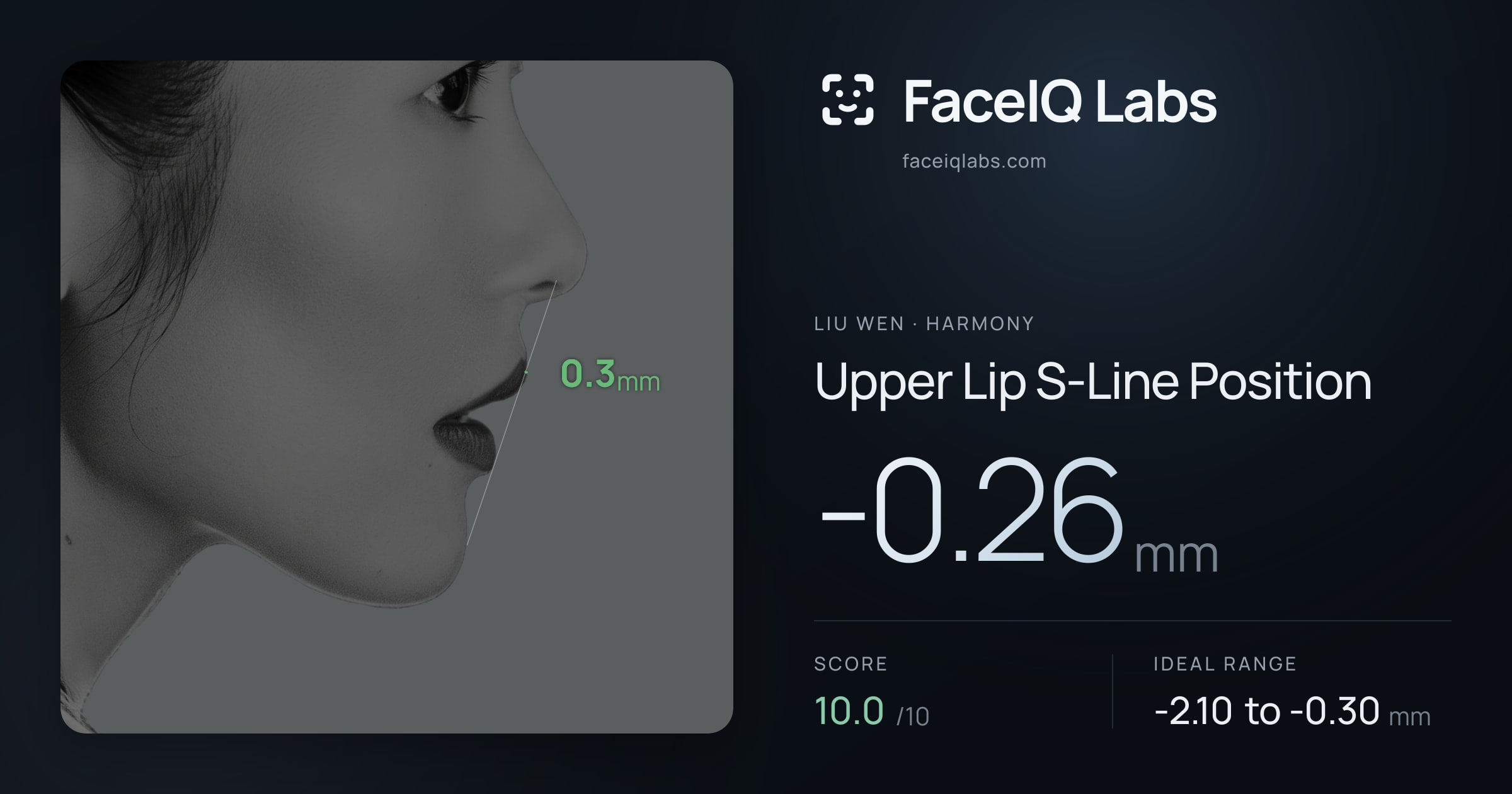 Liu Wen Upper Lip S-Line Position: -0.26mm, drawn on the photo