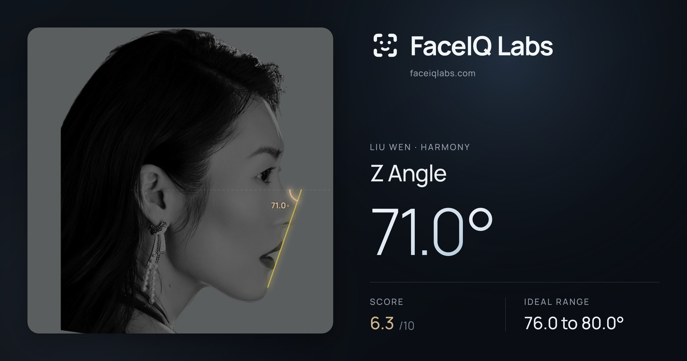Liu Wen Z Angle: 71.0°, drawn on the photo