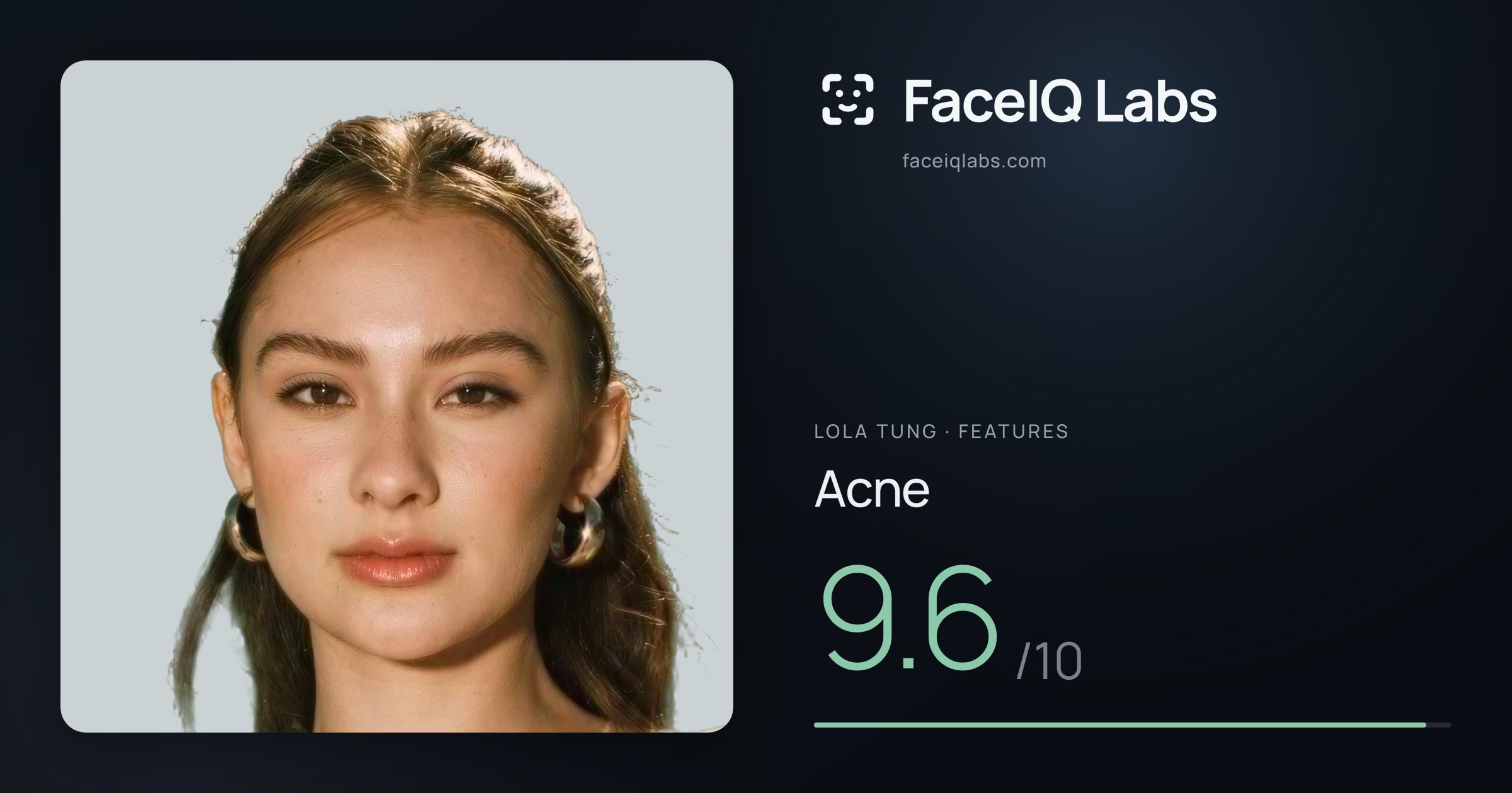 Lola Tung Acne: 9.6/10, drawn on the photo