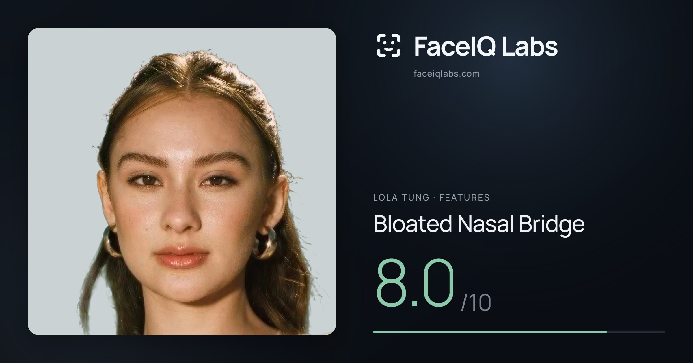 Lola Tung Bloated Nasal Bridge: 8.0/10, drawn on the photo
