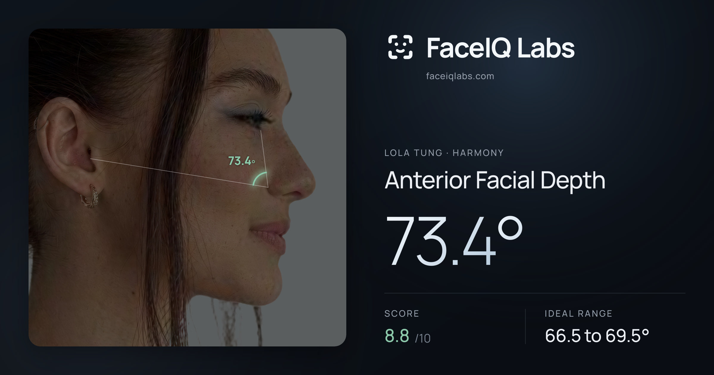 Lola Tung Anterior Facial Depth: 73.4°, drawn on the photo