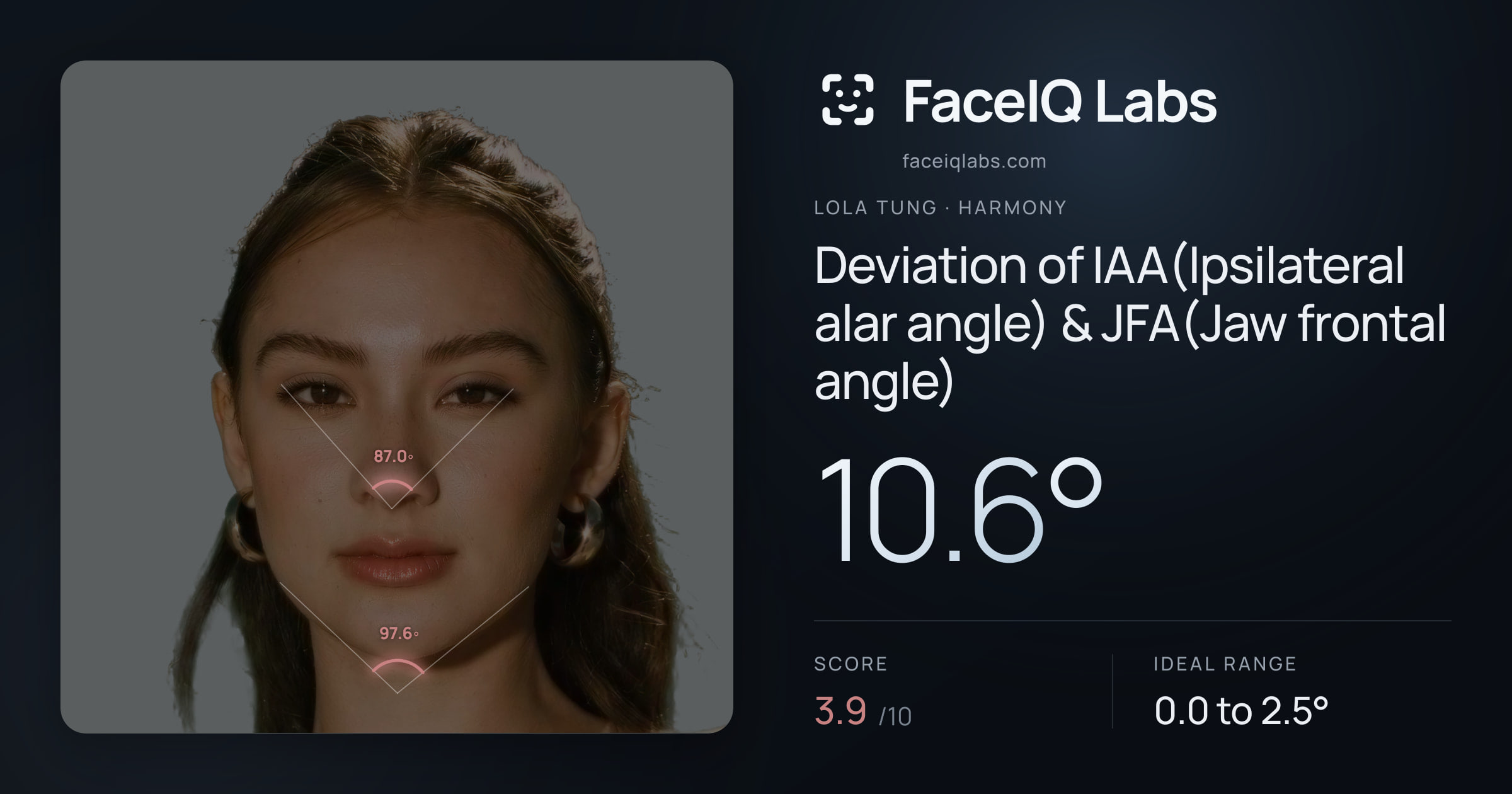 Lola Tung Deviation of IAA(Ipsilateral alar angle) & JFA(Jaw frontal angle): 10.6°, drawn on the photo