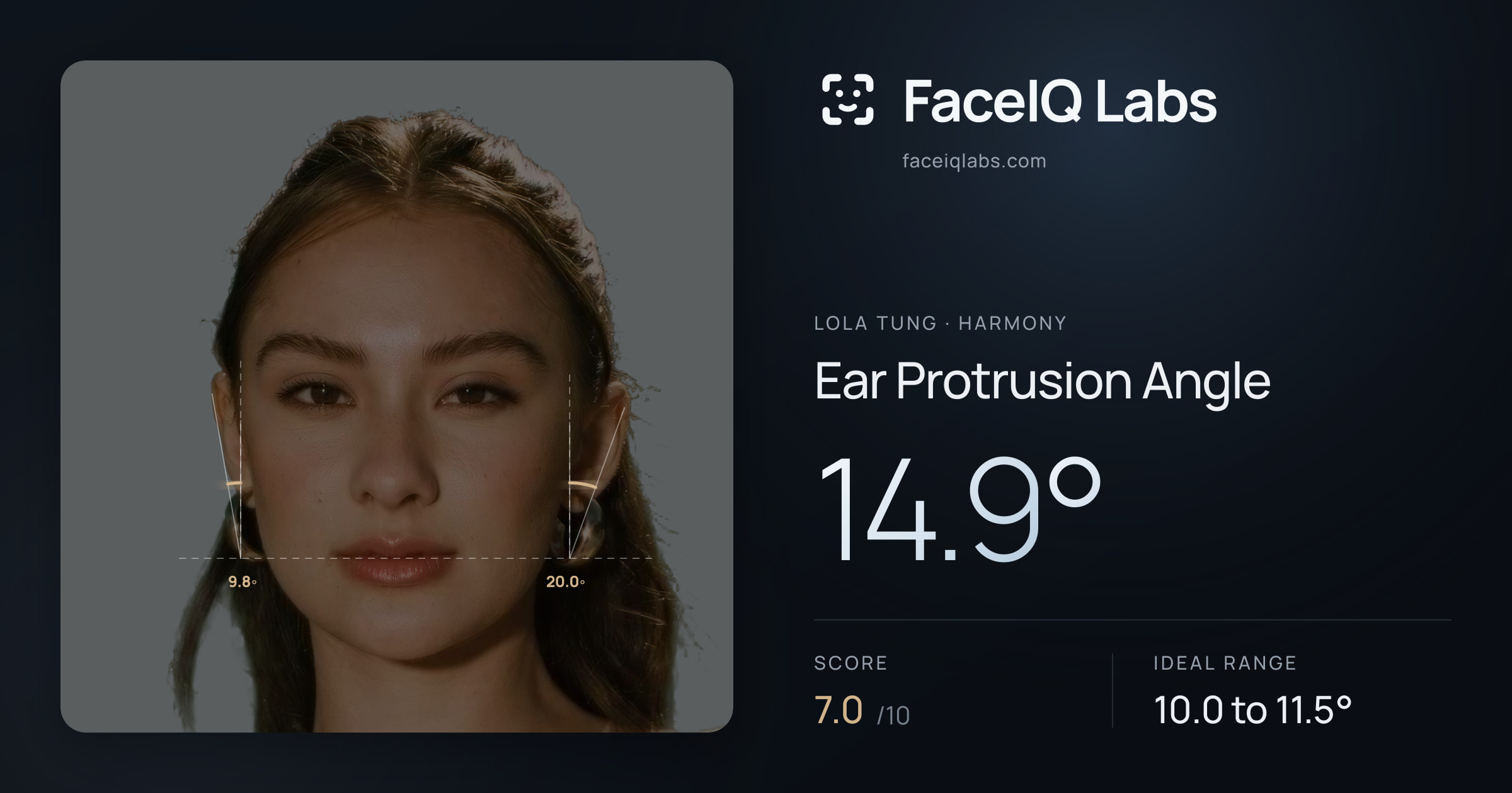 Lola Tung Ear Protrusion Angle: 14.9°, drawn on the photo