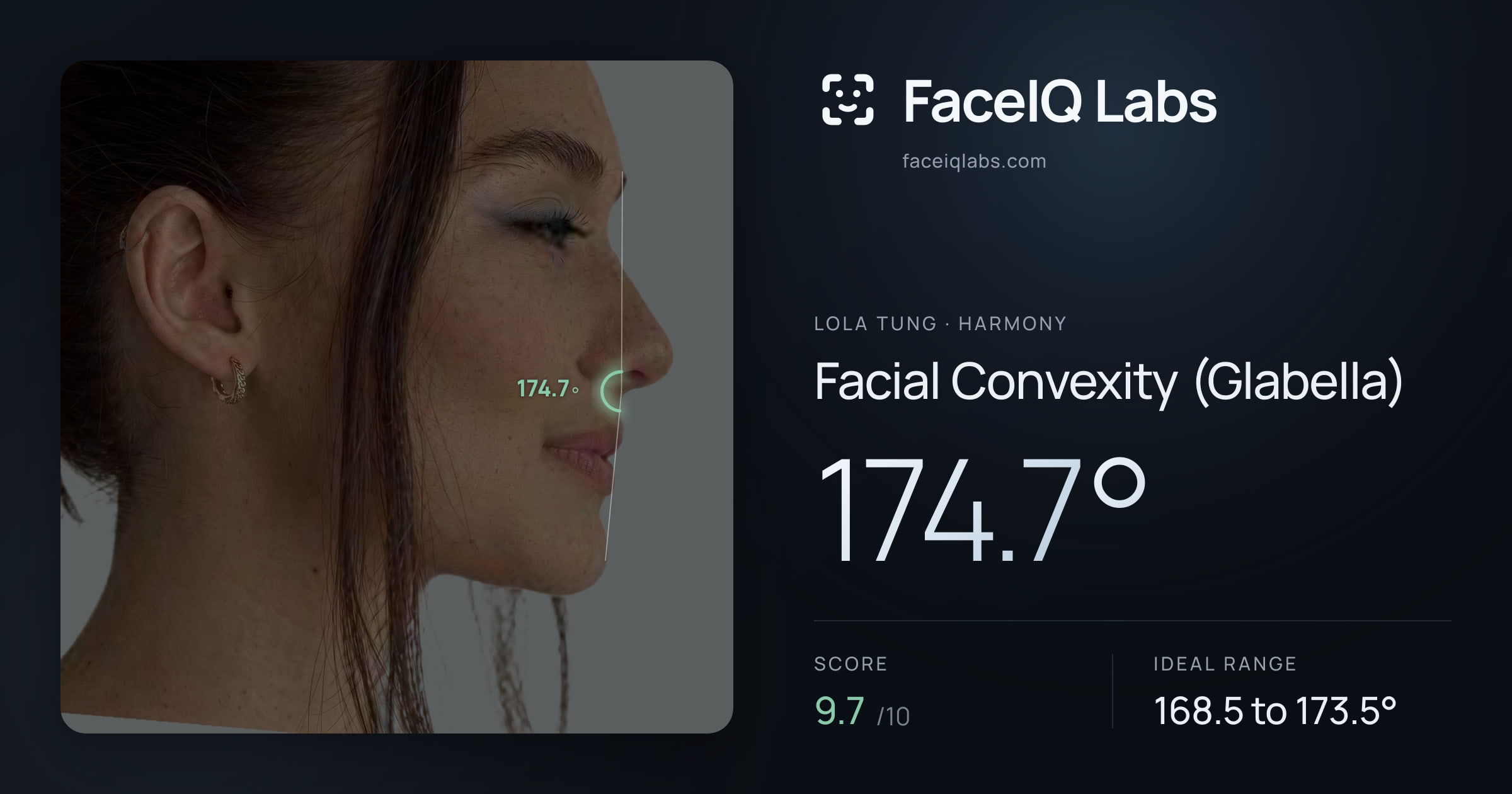 Lola Tung Facial Convexity (Glabella): 174.7°, drawn on the photo