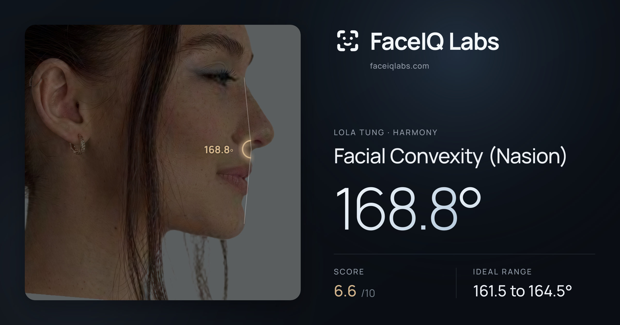 Lola Tung Facial Convexity (Nasion): 168.8°, drawn on the photo