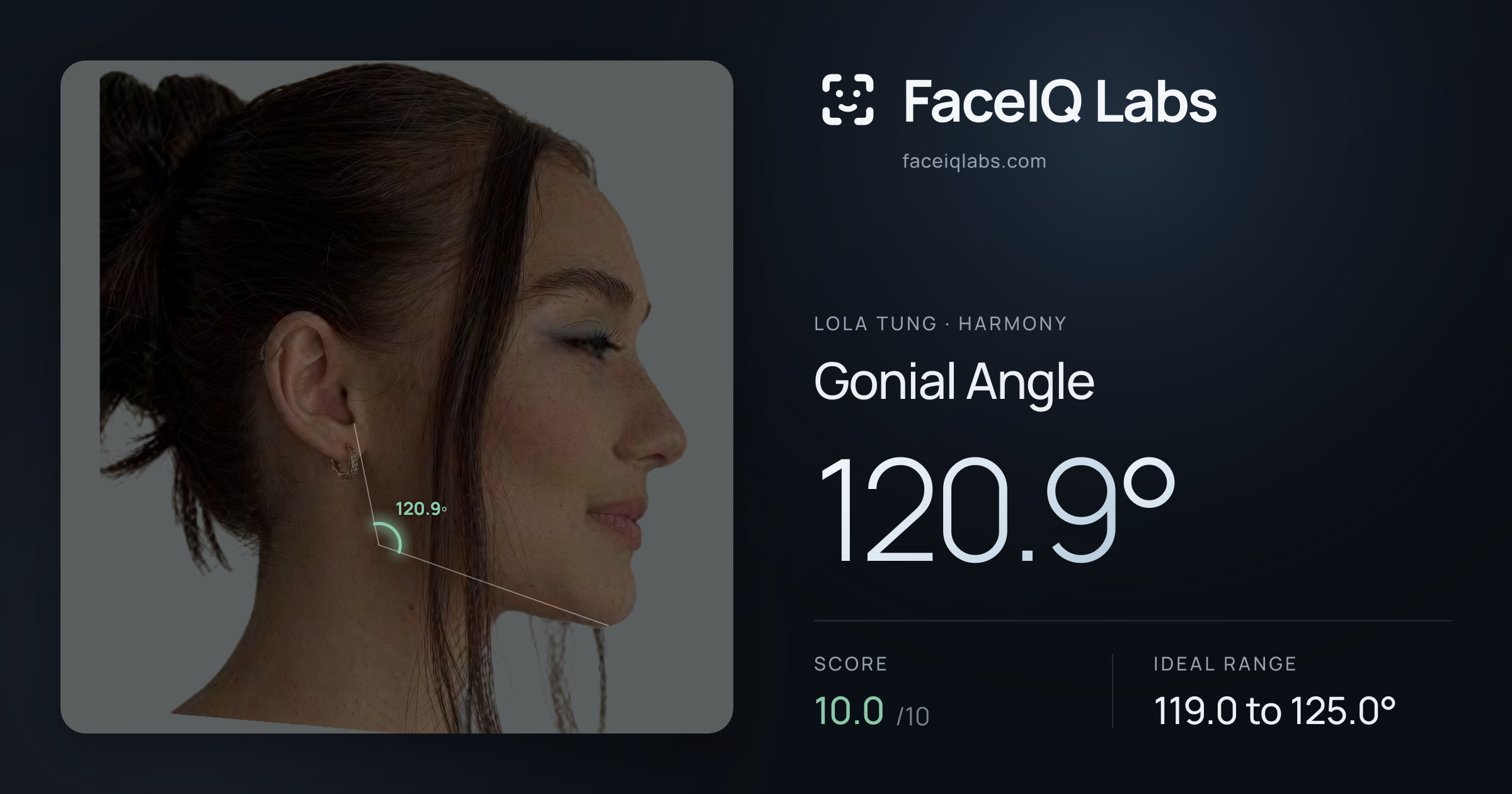 Lola Tung Gonial Angle: 120.9°, drawn on the photo