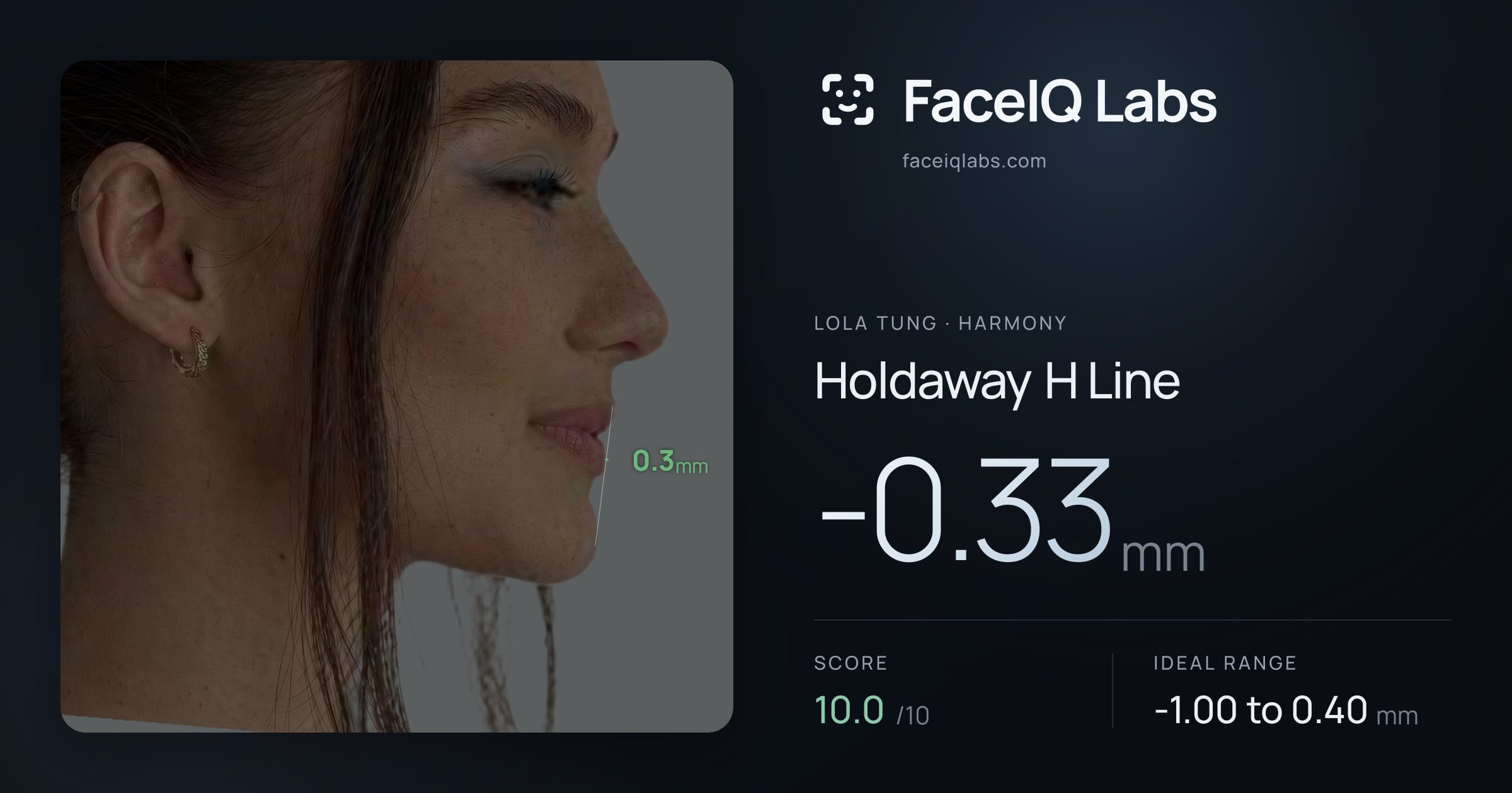 Lola Tung Holdaway H Line: -0.33mm, drawn on the photo