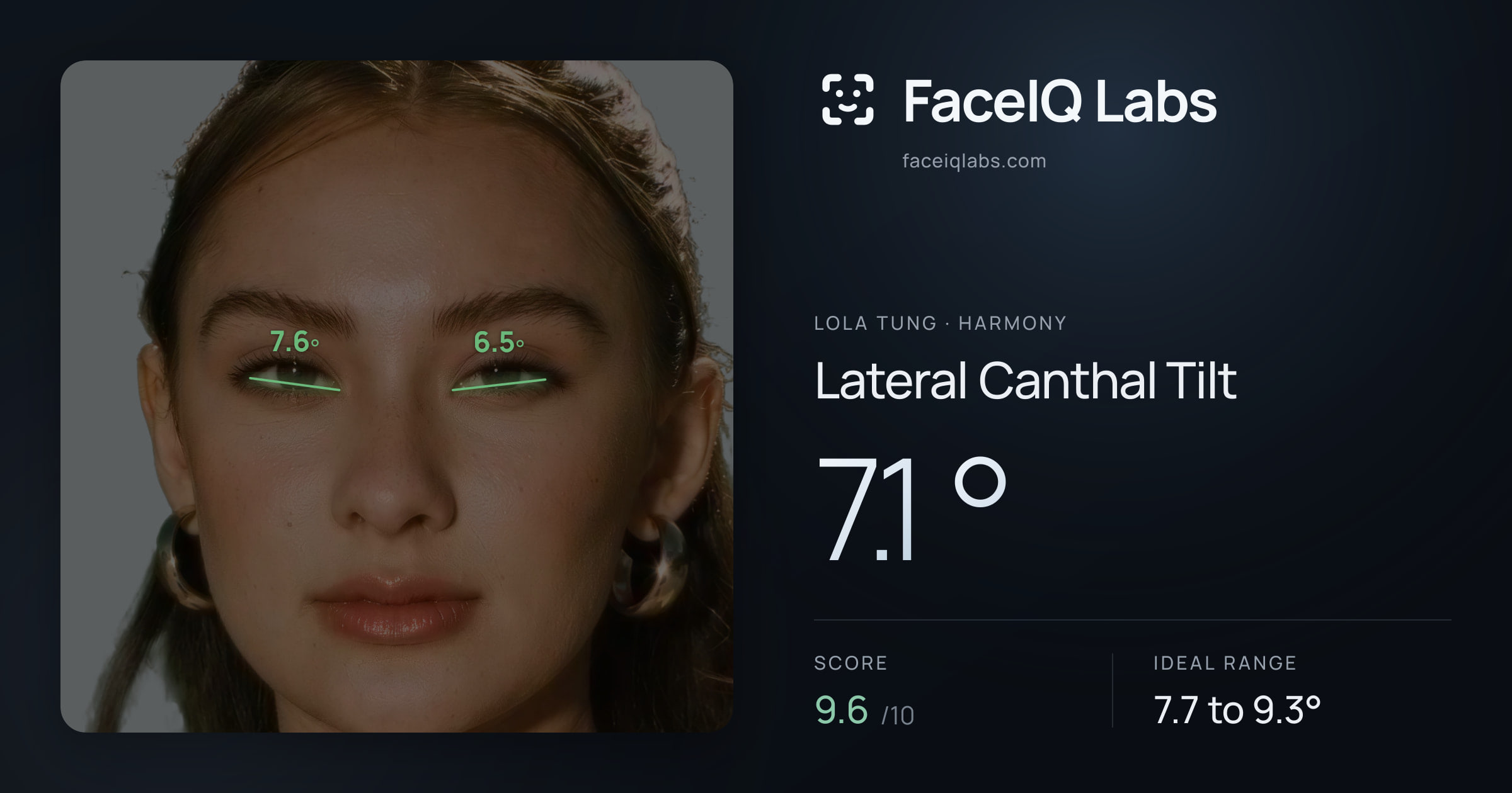 Lola Tung Lateral Canthal Tilt: 7.1°, drawn on the photo