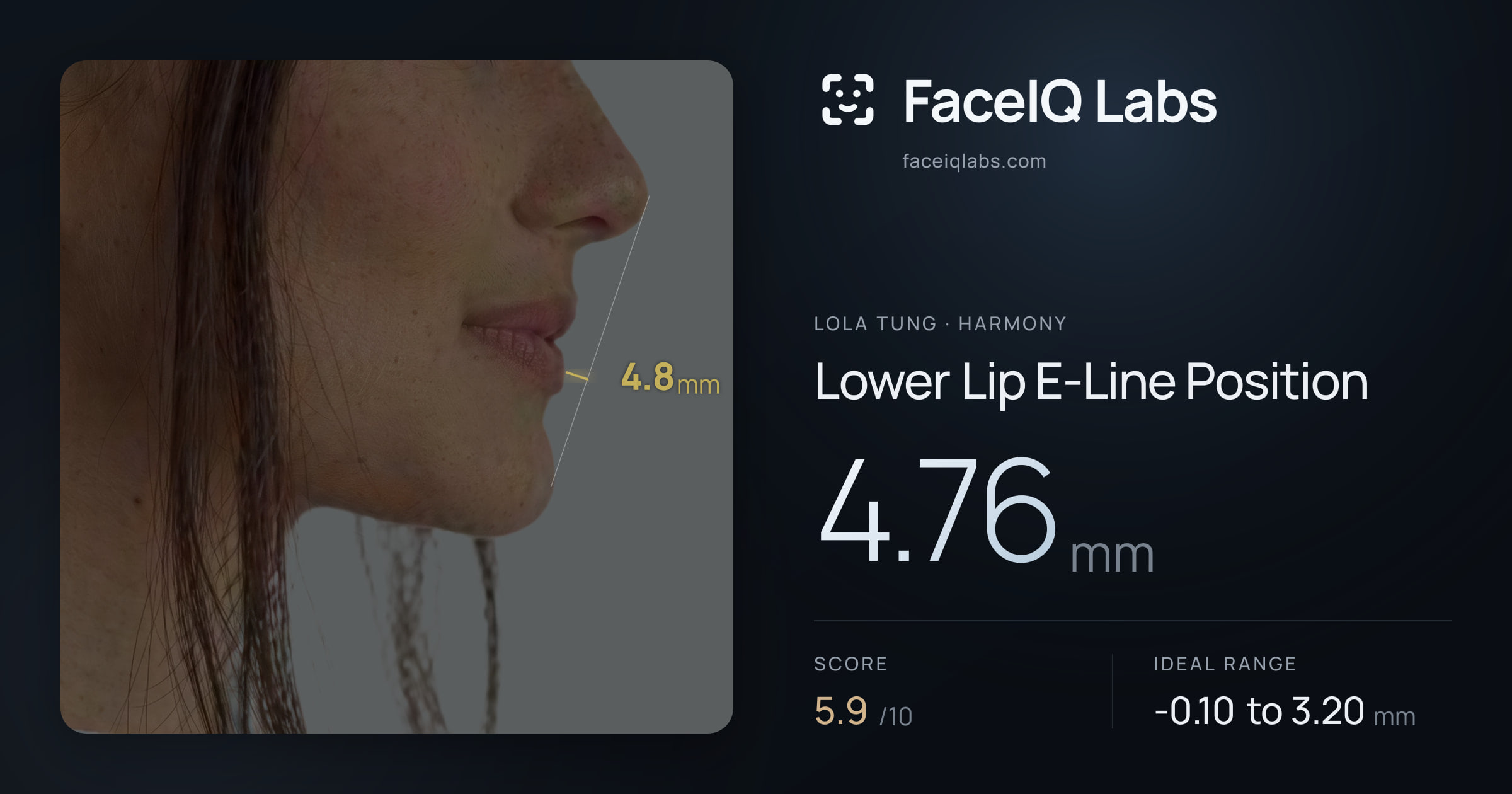 Lola Tung Lower Lip E-Line Position: 4.76mm, drawn on the photo