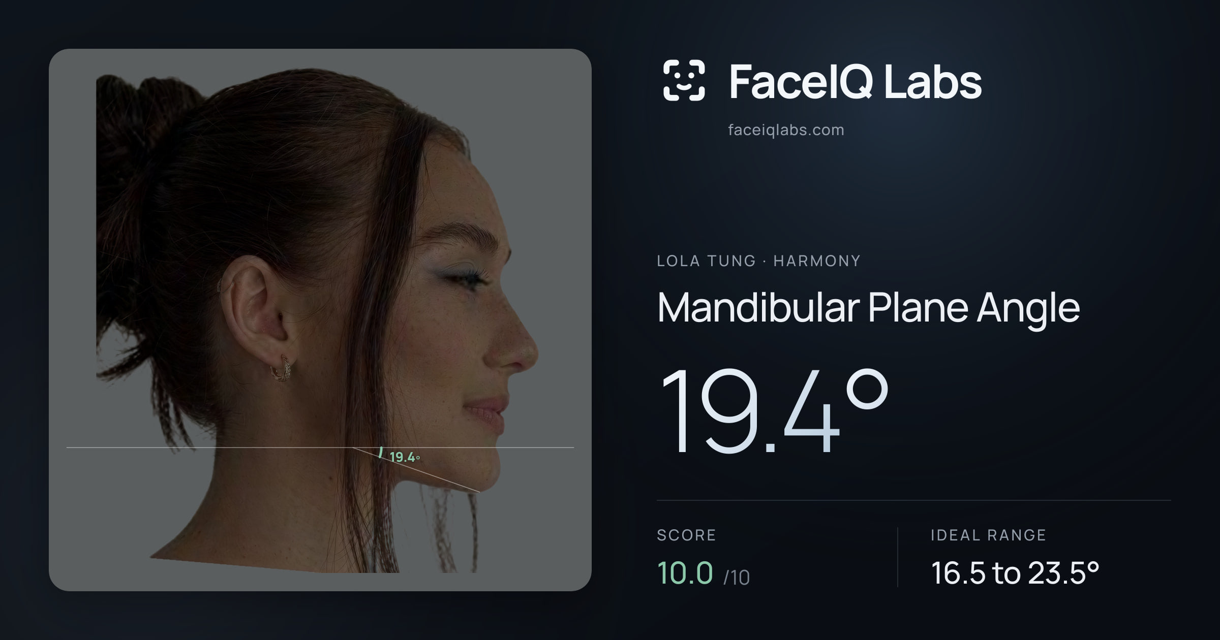 Lola Tung Mandibular Plane Angle: 19.4°, drawn on the photo