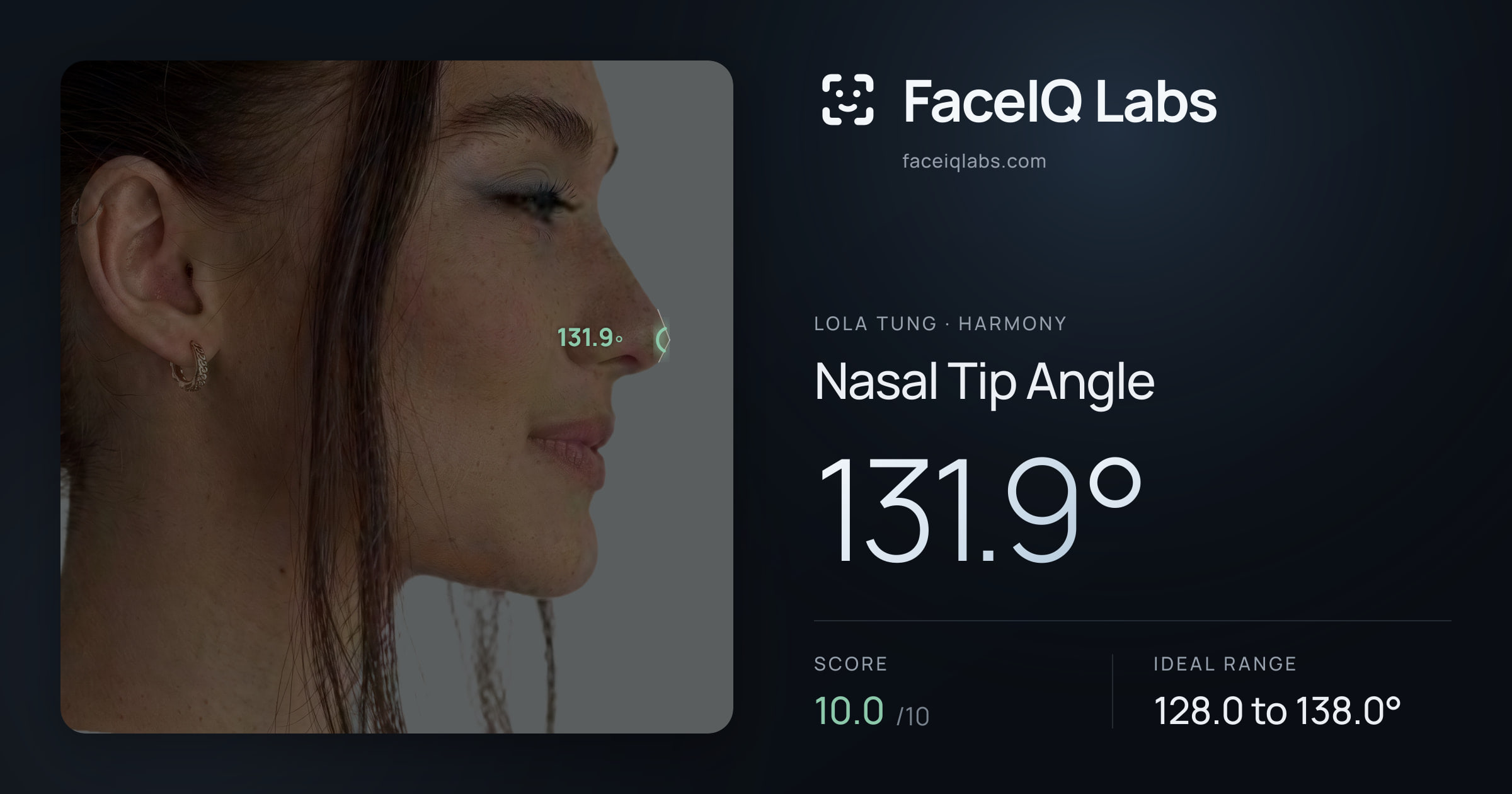 Lola Tung Nasal Tip Angle: 131.9°, drawn on the photo
