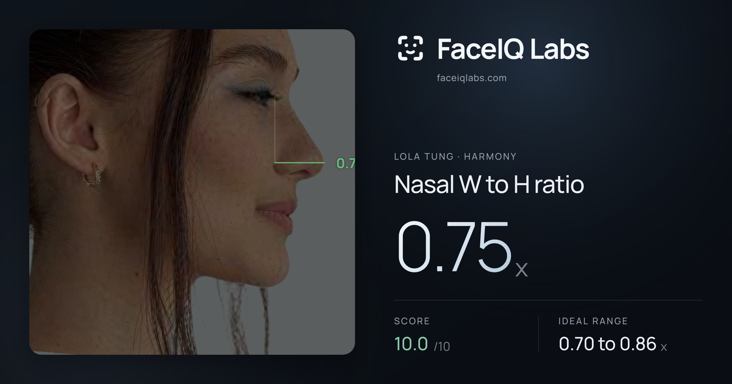 Lola Tung Nasal W to H ratio: 0.75x, drawn on the photo