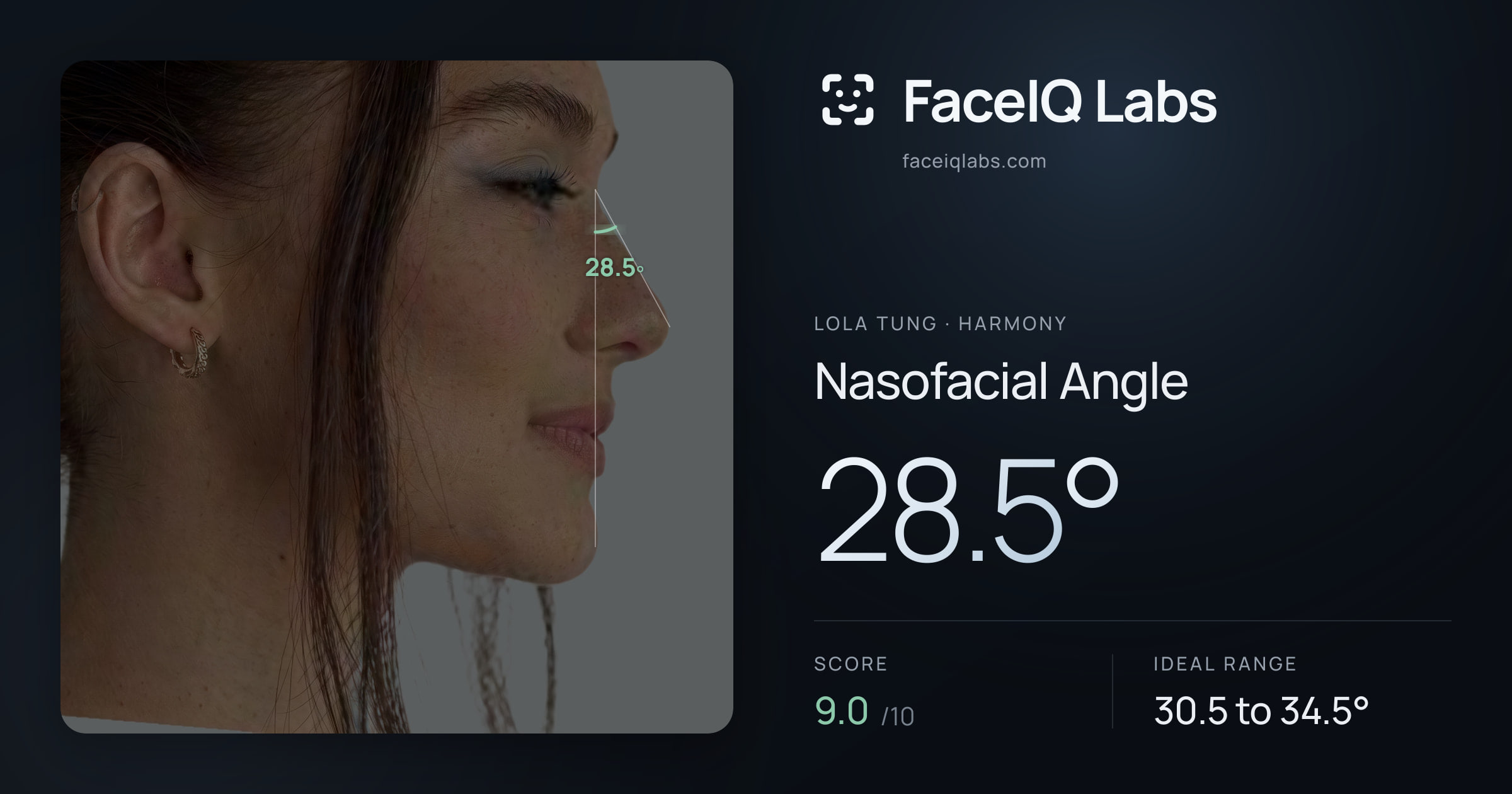 Lola Tung Nasofacial Angle: 28.5°, drawn on the photo