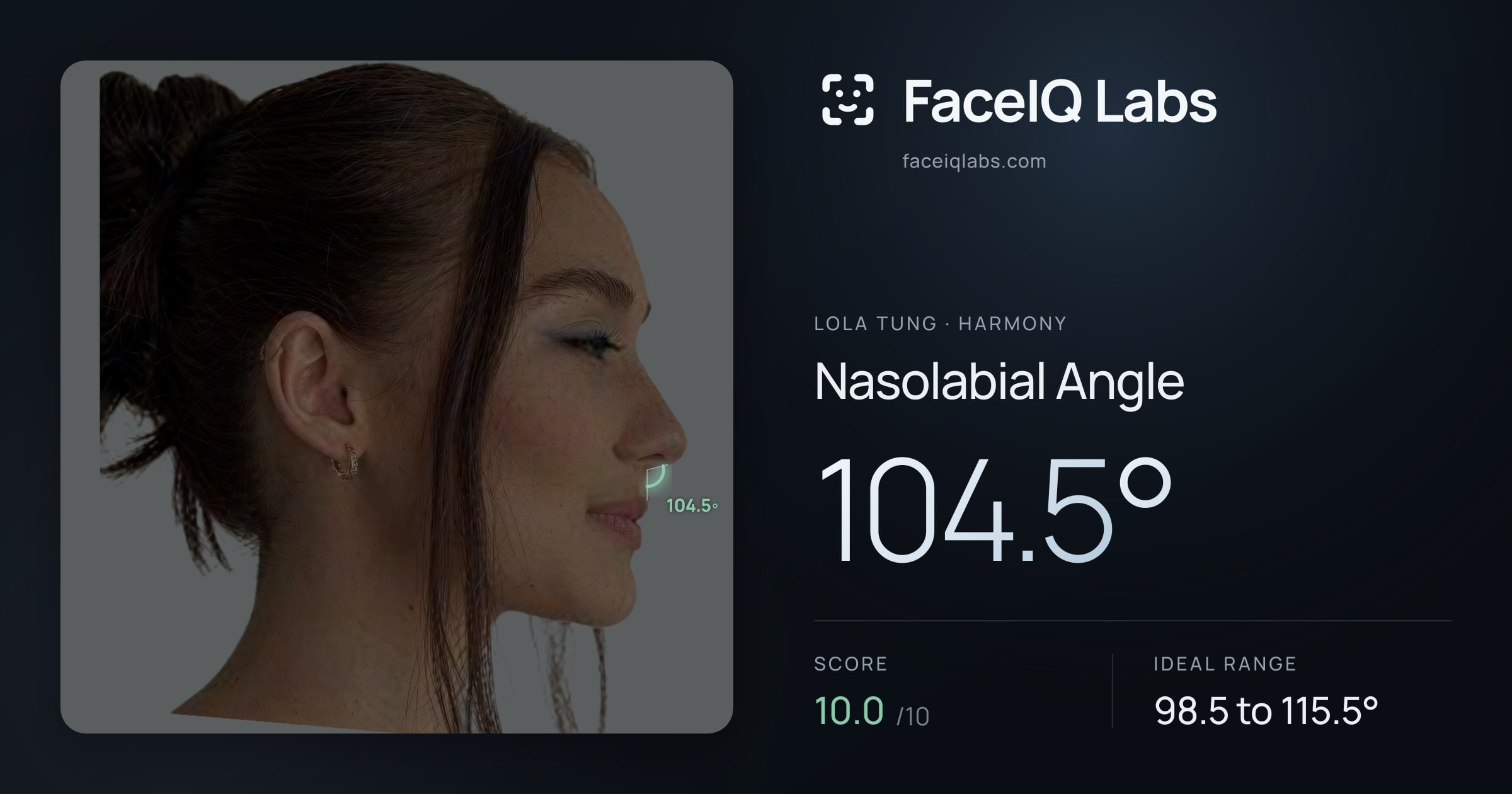 Lola Tung Nasolabial Angle: 104.5°, drawn on the photo