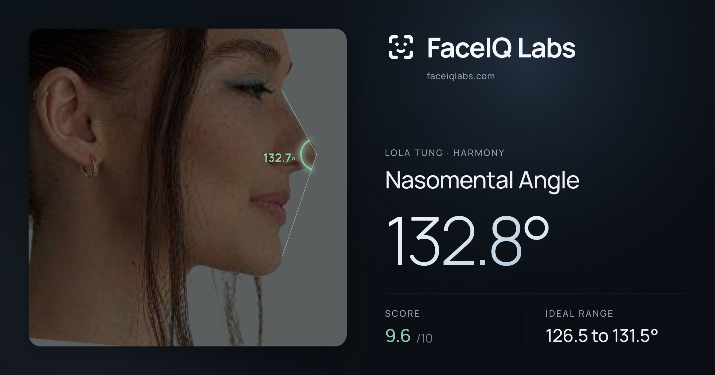Lola Tung Nasomental Angle: 132.8°, drawn on the photo