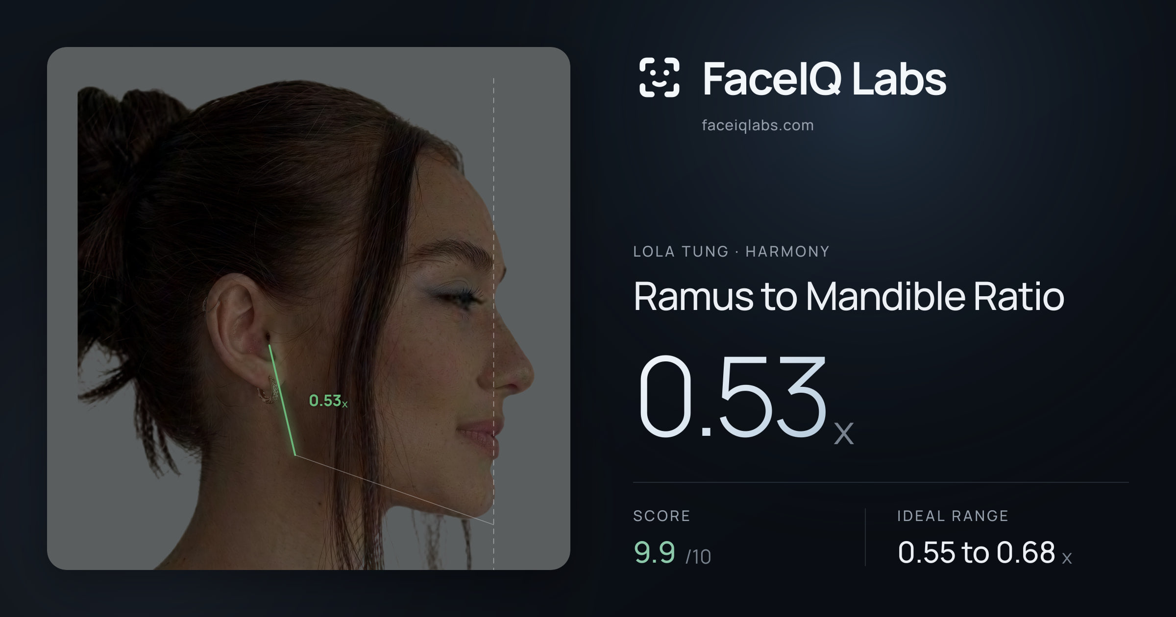 Lola Tung Ramus to Mandible Ratio: 0.53x, drawn on the photo
