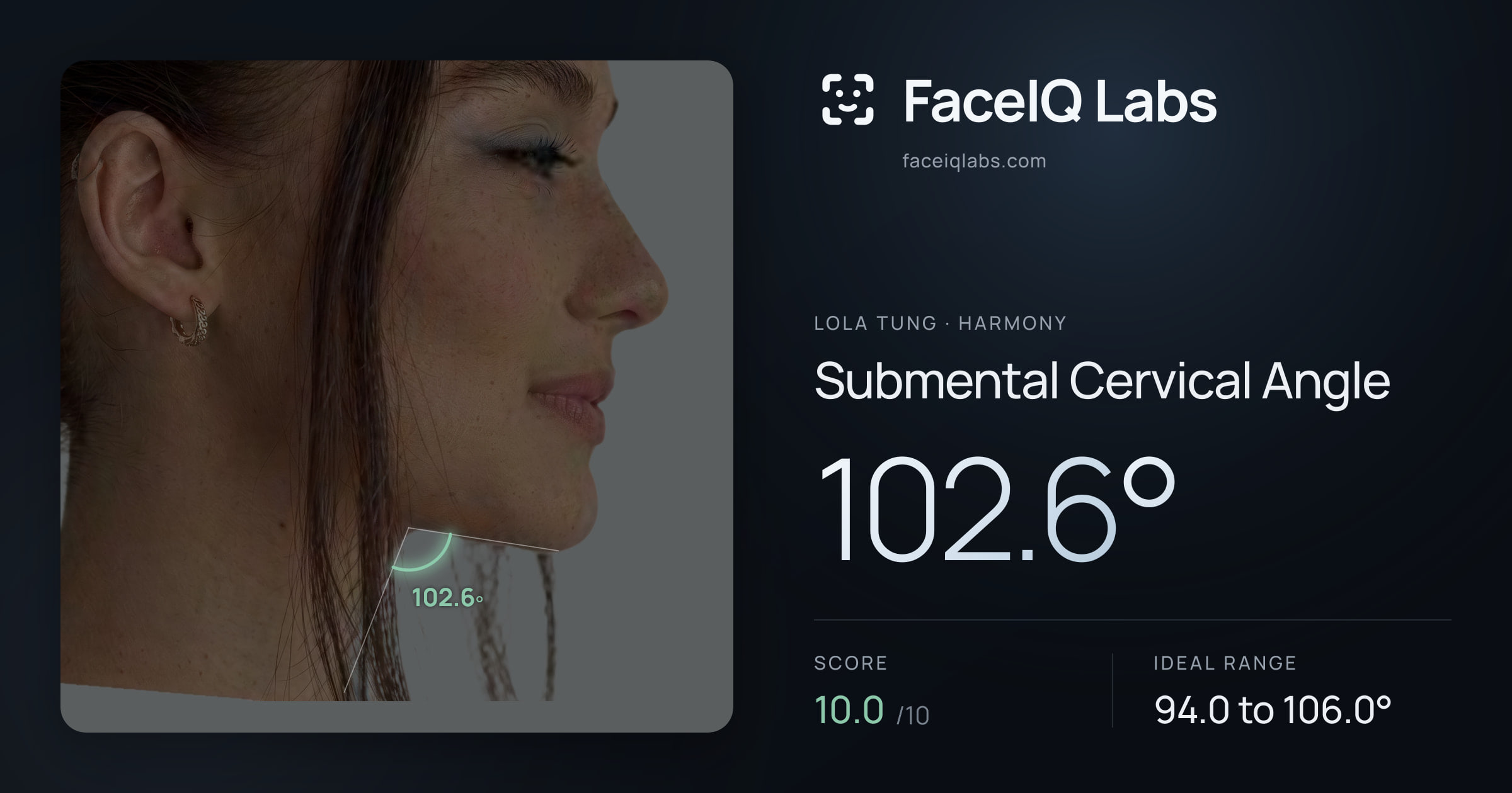 Lola Tung Submental Cervical Angle: 102.6°, drawn on the photo
