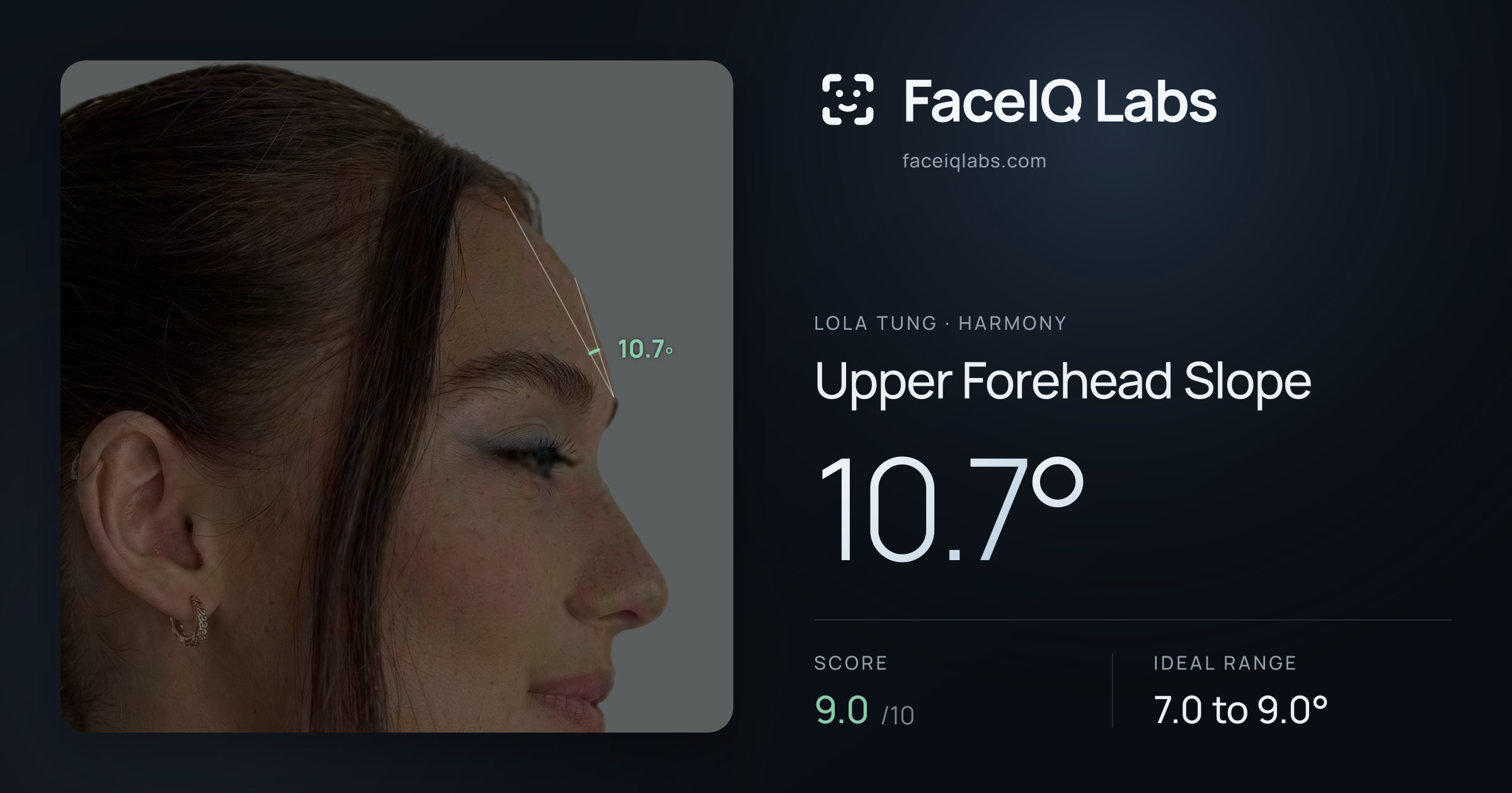 Lola Tung Upper Forehead Slope: 10.7°, drawn on the photo