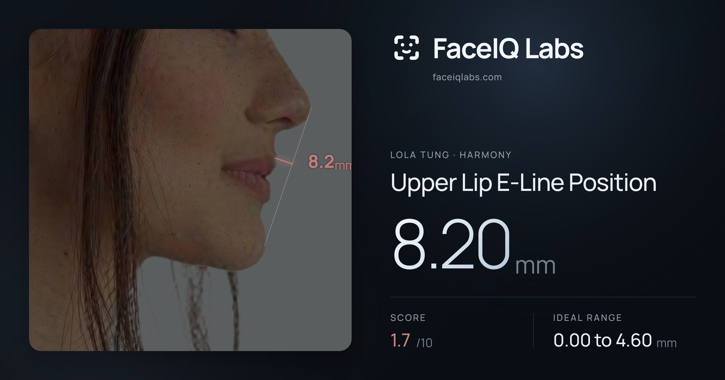Lola Tung Upper Lip E-Line Position: 8.20mm, drawn on the photo