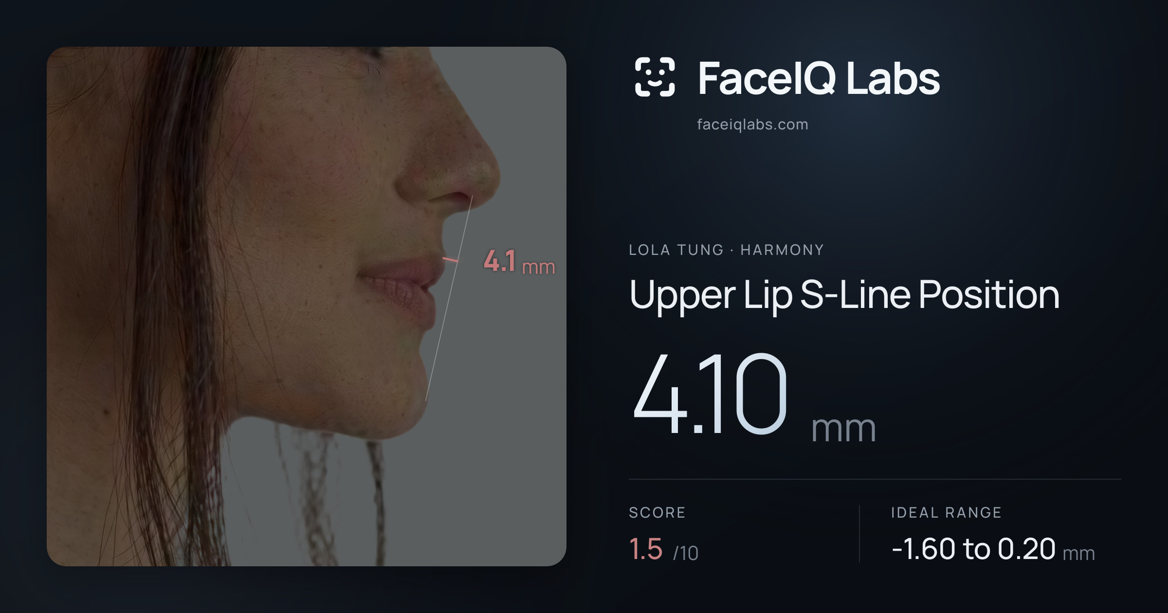Lola Tung Upper Lip S-Line Position: 4.10mm, drawn on the photo