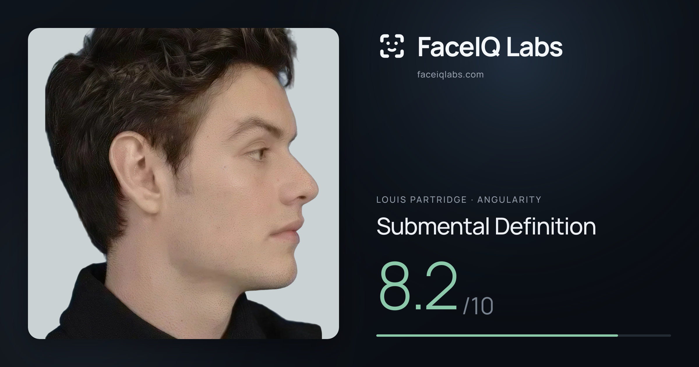 Louis Partridge Submental Definition: 8.2/10, drawn on the photo