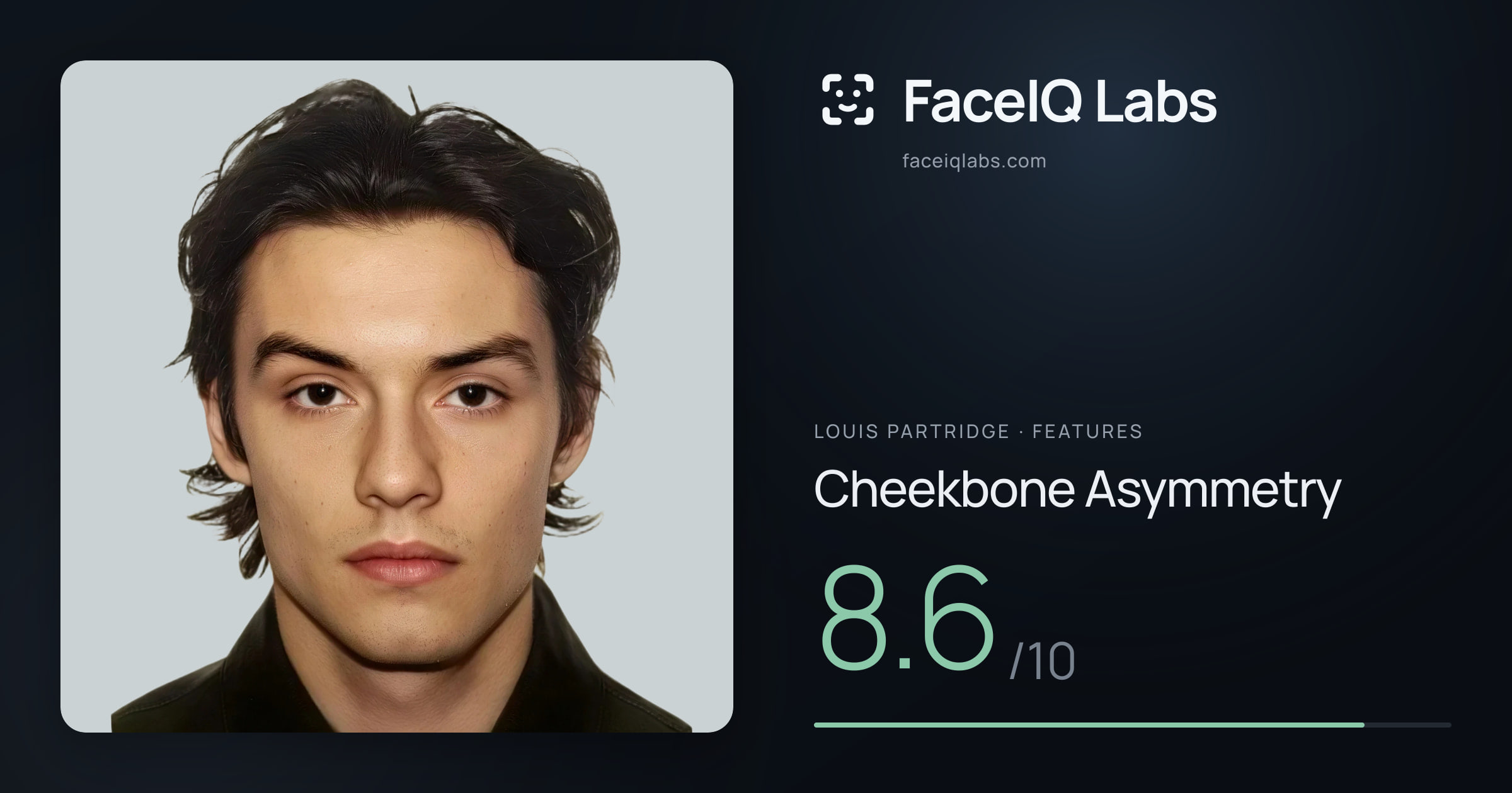 Louis Partridge Cheekbone Asymmetry: 8.6/10, drawn on the photo