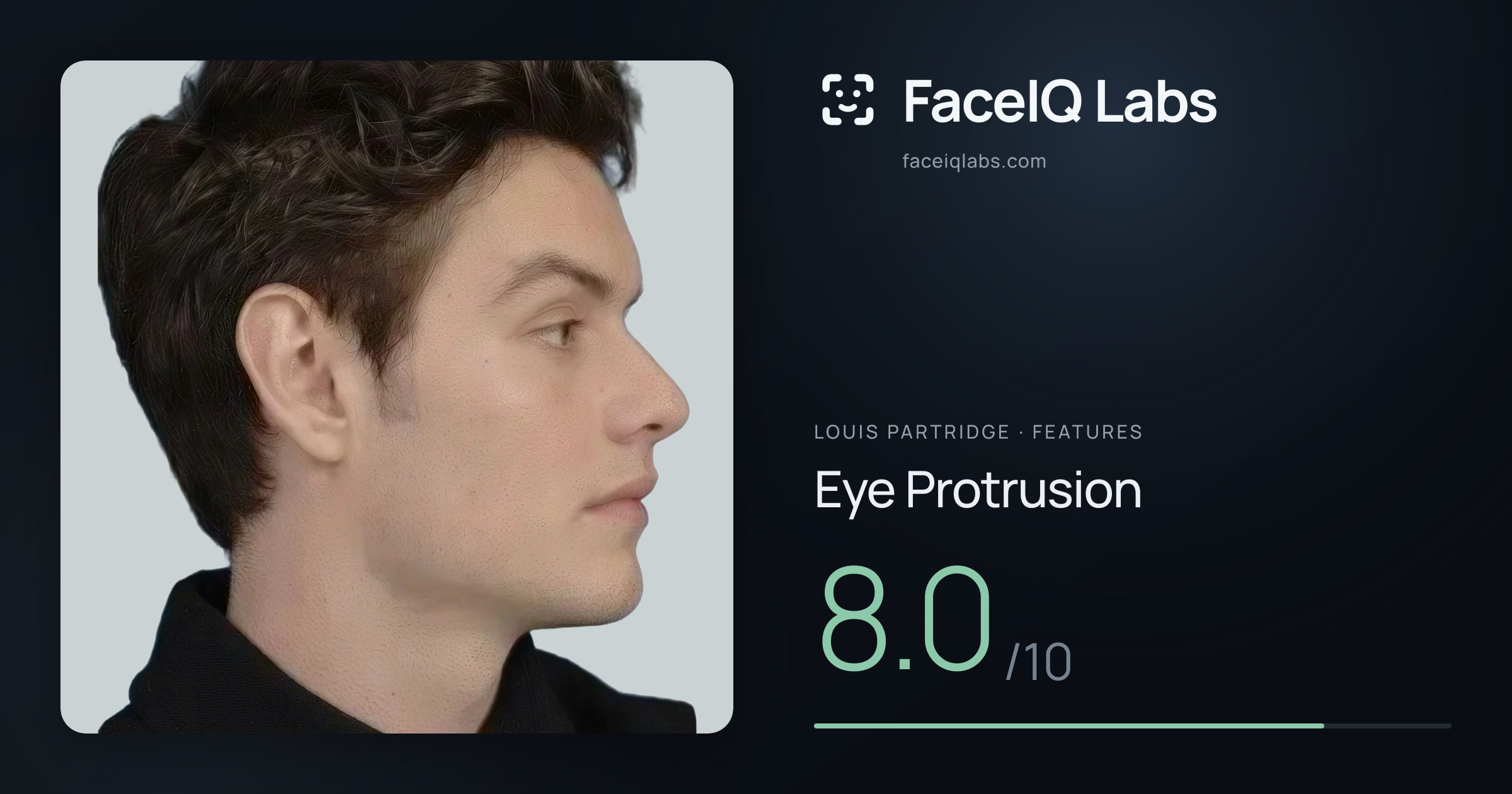 Louis Partridge Eye Protrusion: 8.0/10, drawn on the photo