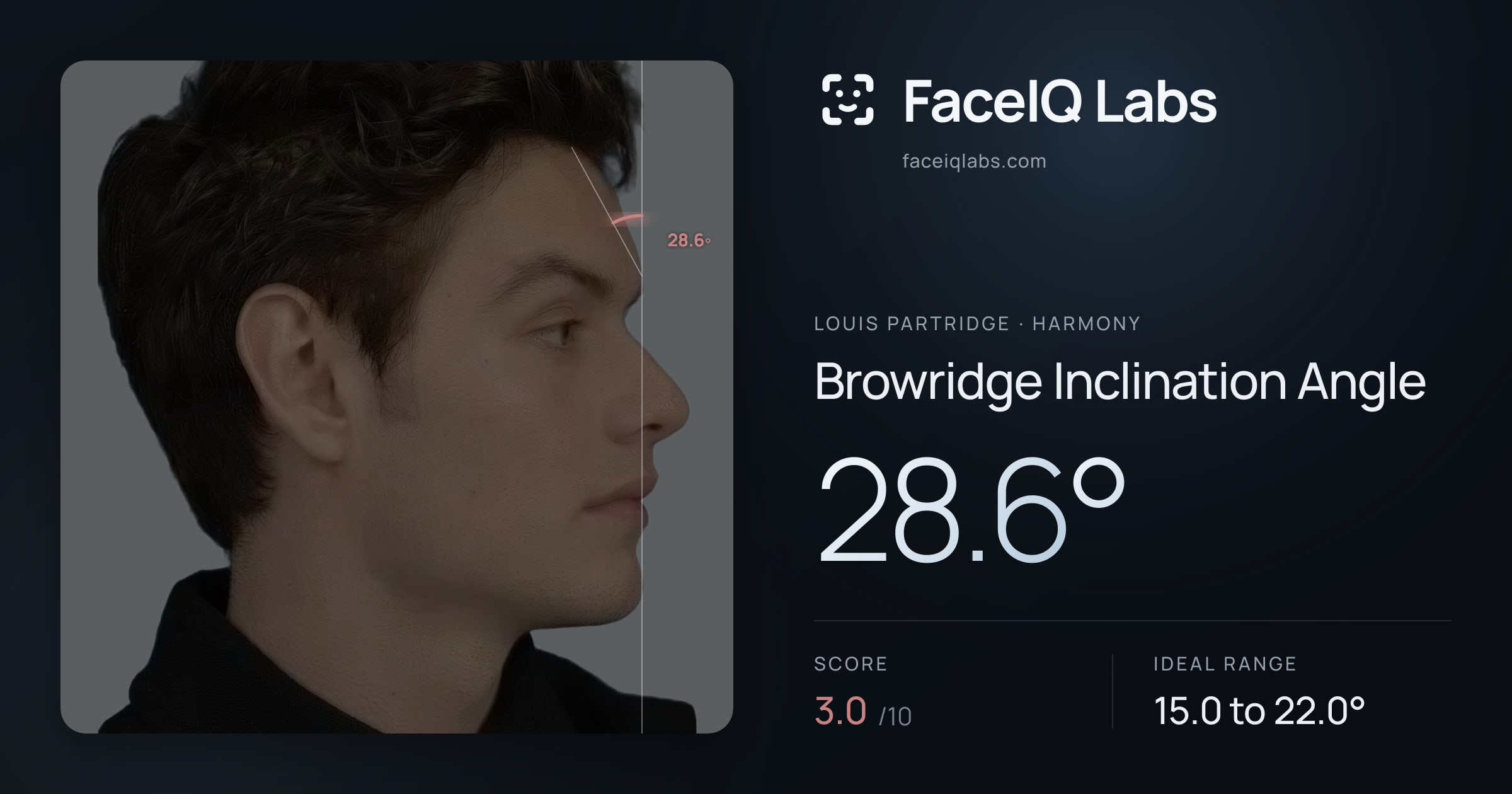 Louis Partridge Browridge Inclination Angle: 28.6°, drawn on the photo