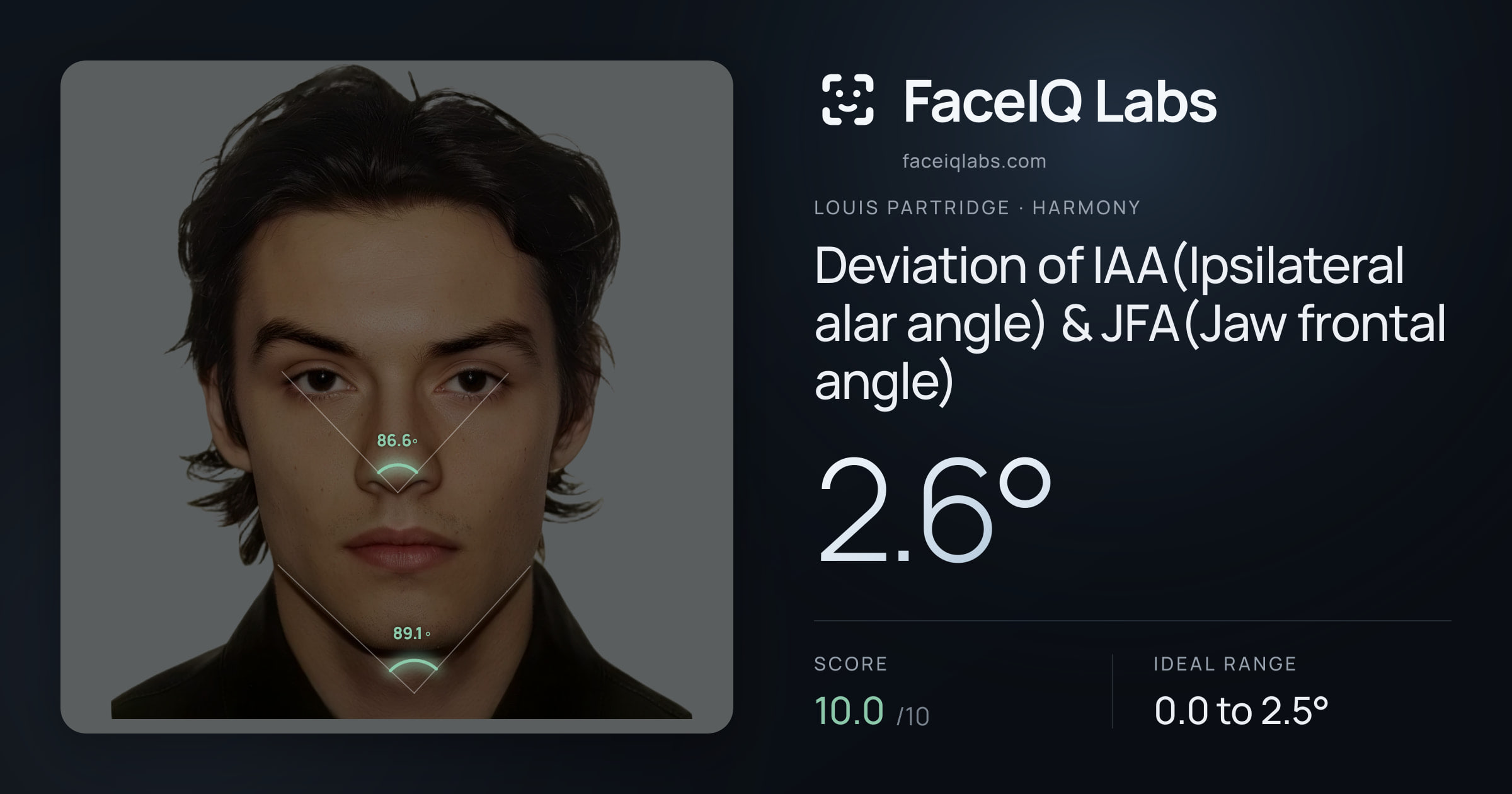 Louis Partridge Deviation of IAA(Ipsilateral alar angle) & JFA(Jaw frontal angle): 2.6°, drawn on the photo