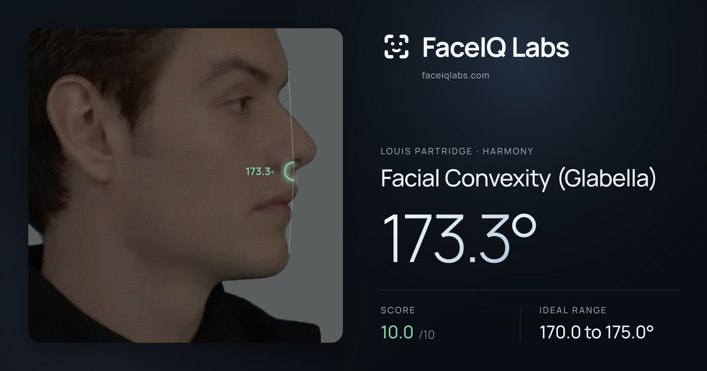 Louis Partridge Facial Convexity (Glabella): 173.3°, drawn on the photo