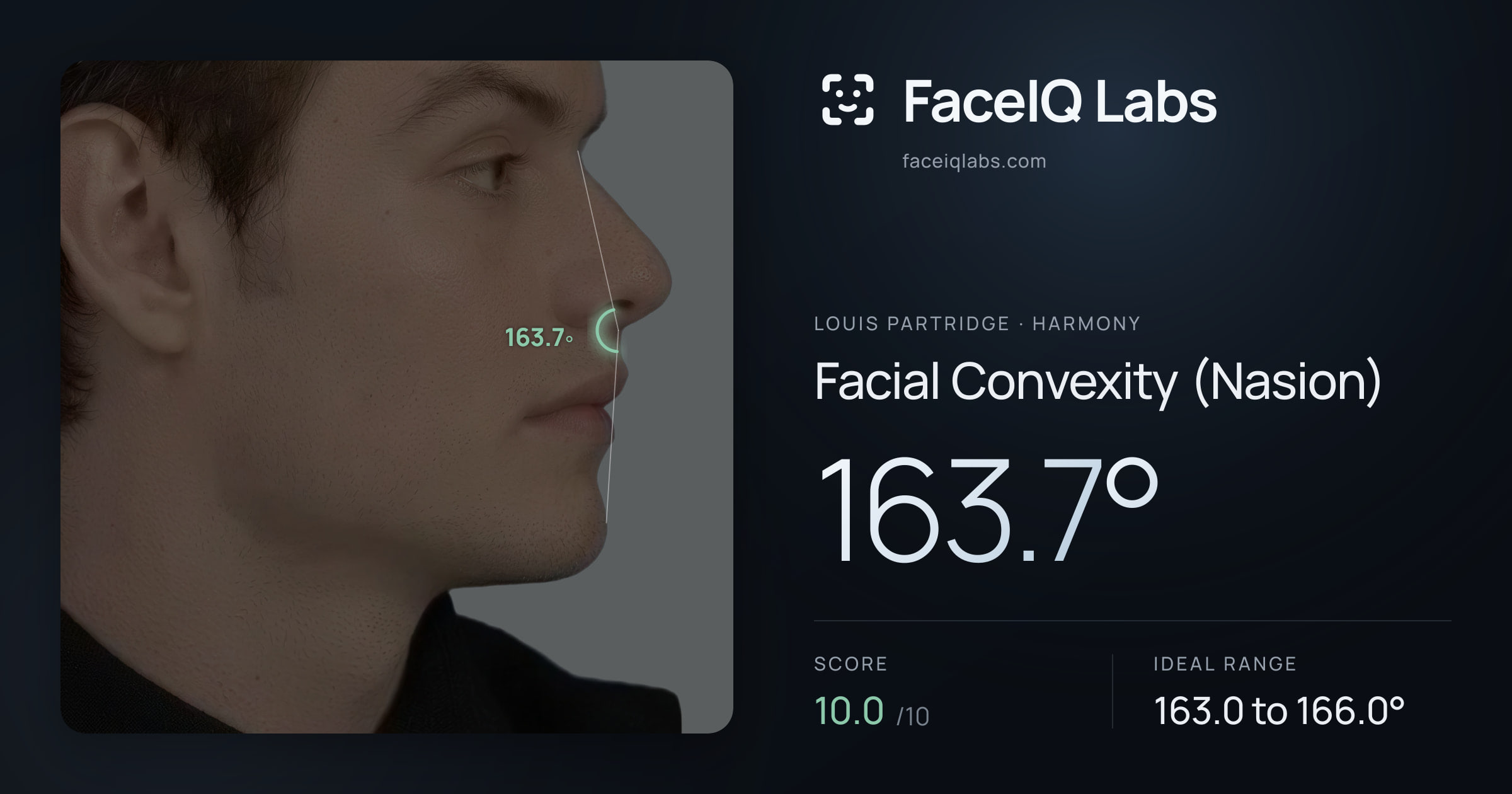 Louis Partridge Facial Convexity (Nasion): 163.7°, drawn on the photo