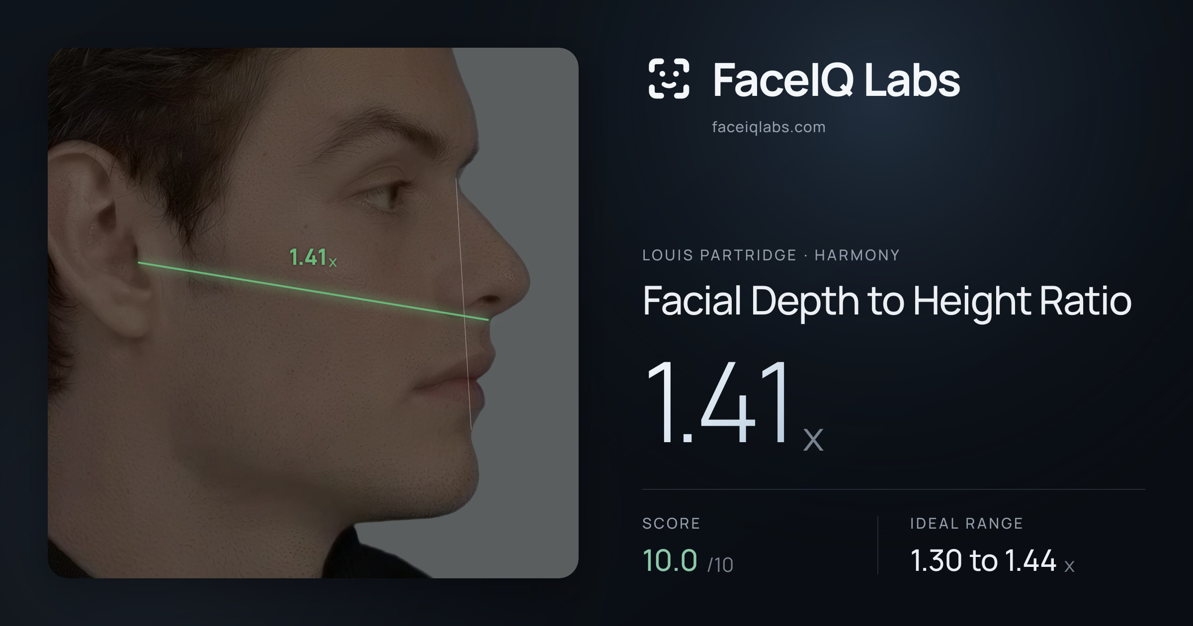 Louis Partridge Facial Depth to Height Ratio: 1.41x, drawn on the photo
