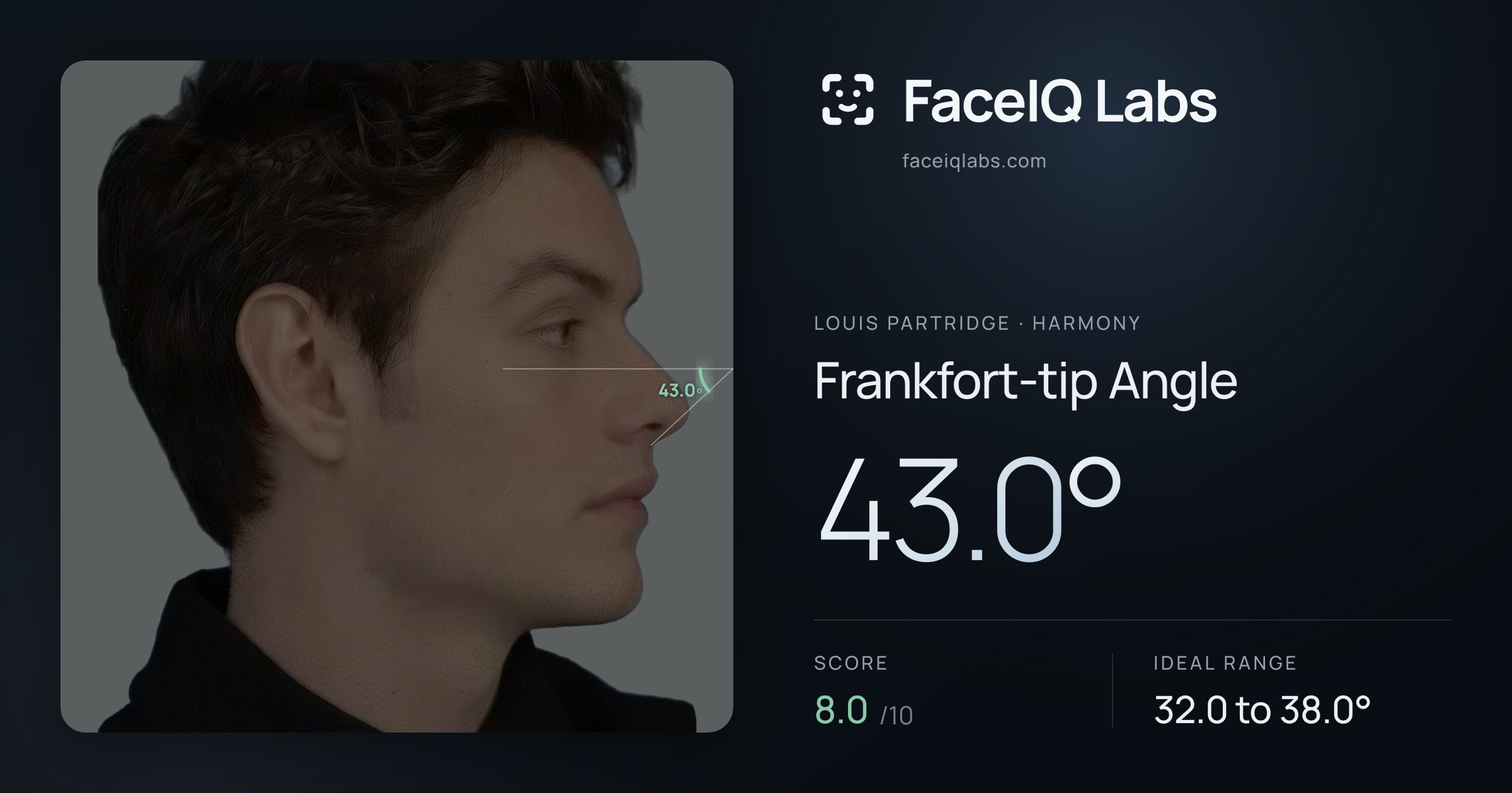 Louis Partridge Frankfort-tip Angle: 43.0°, drawn on the photo