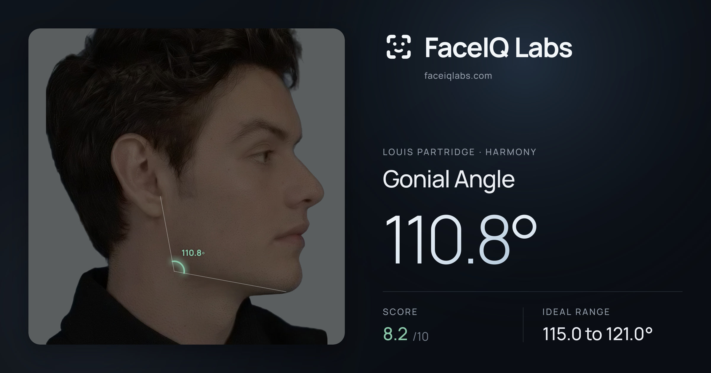 Louis Partridge Gonial Angle: 110.8°, drawn on the photo
