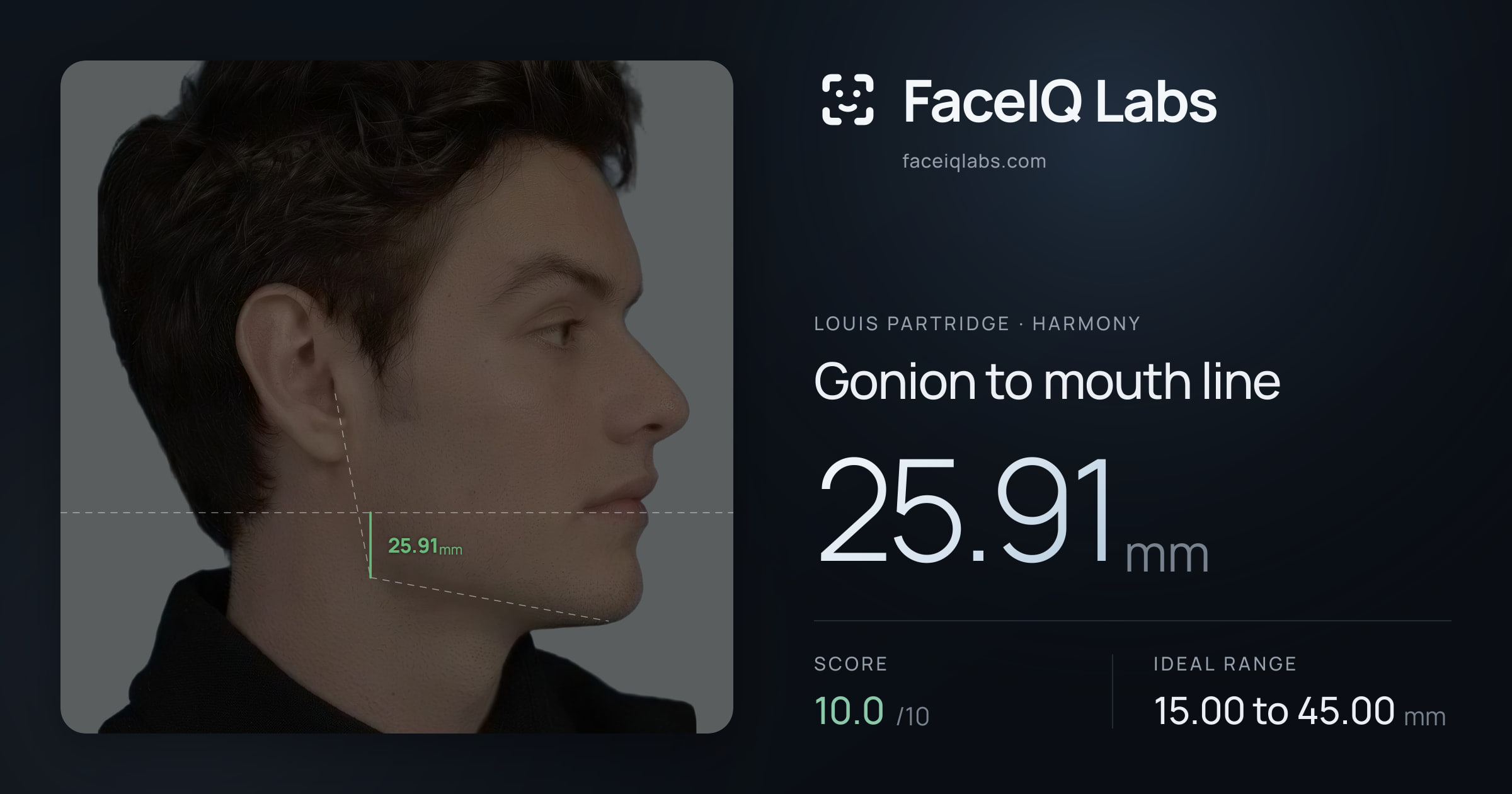 Louis Partridge Gonion to mouth line: 25.91mm, drawn on the photo