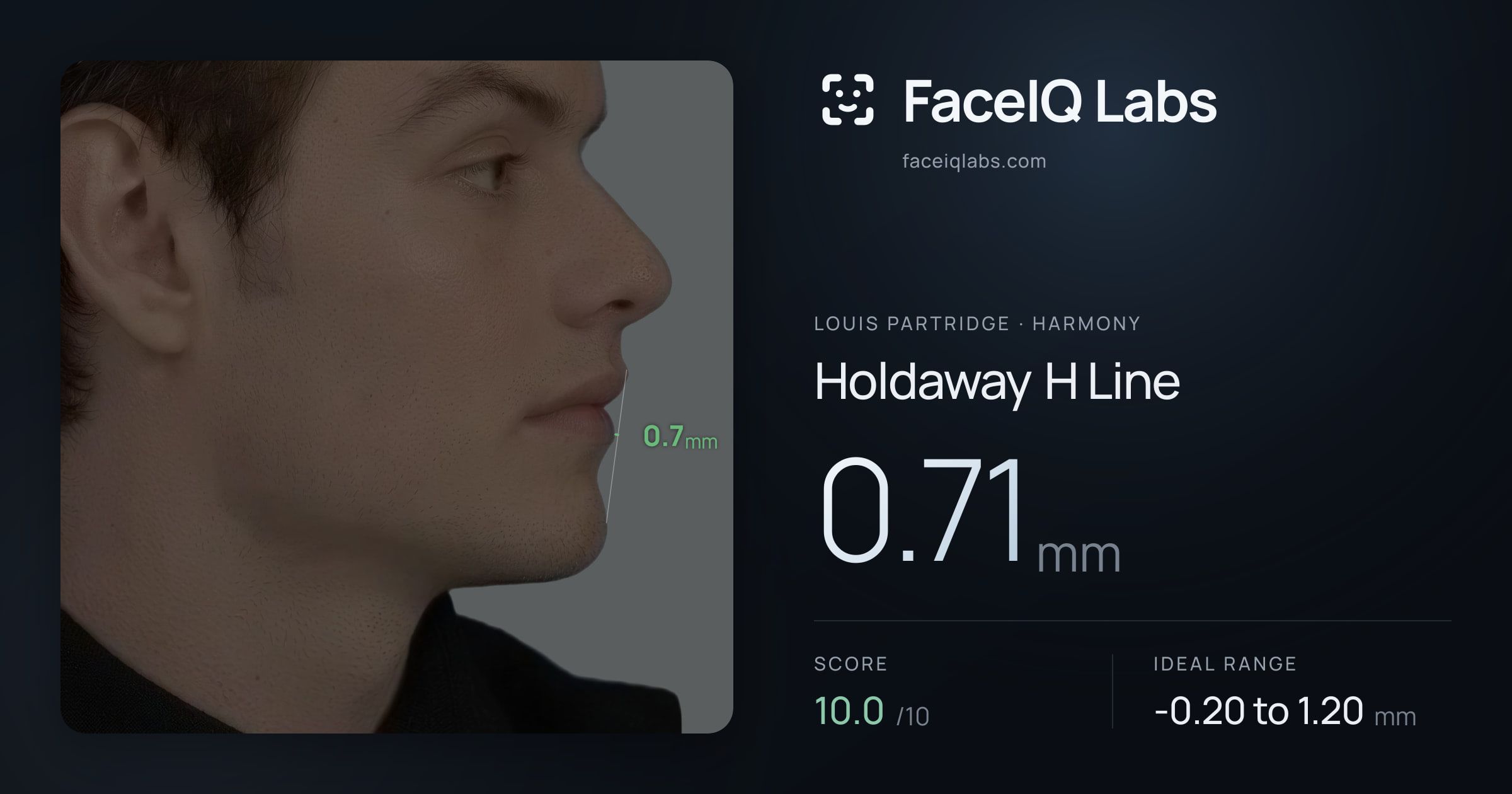 Louis Partridge Holdaway H Line: 0.71mm, drawn on the photo