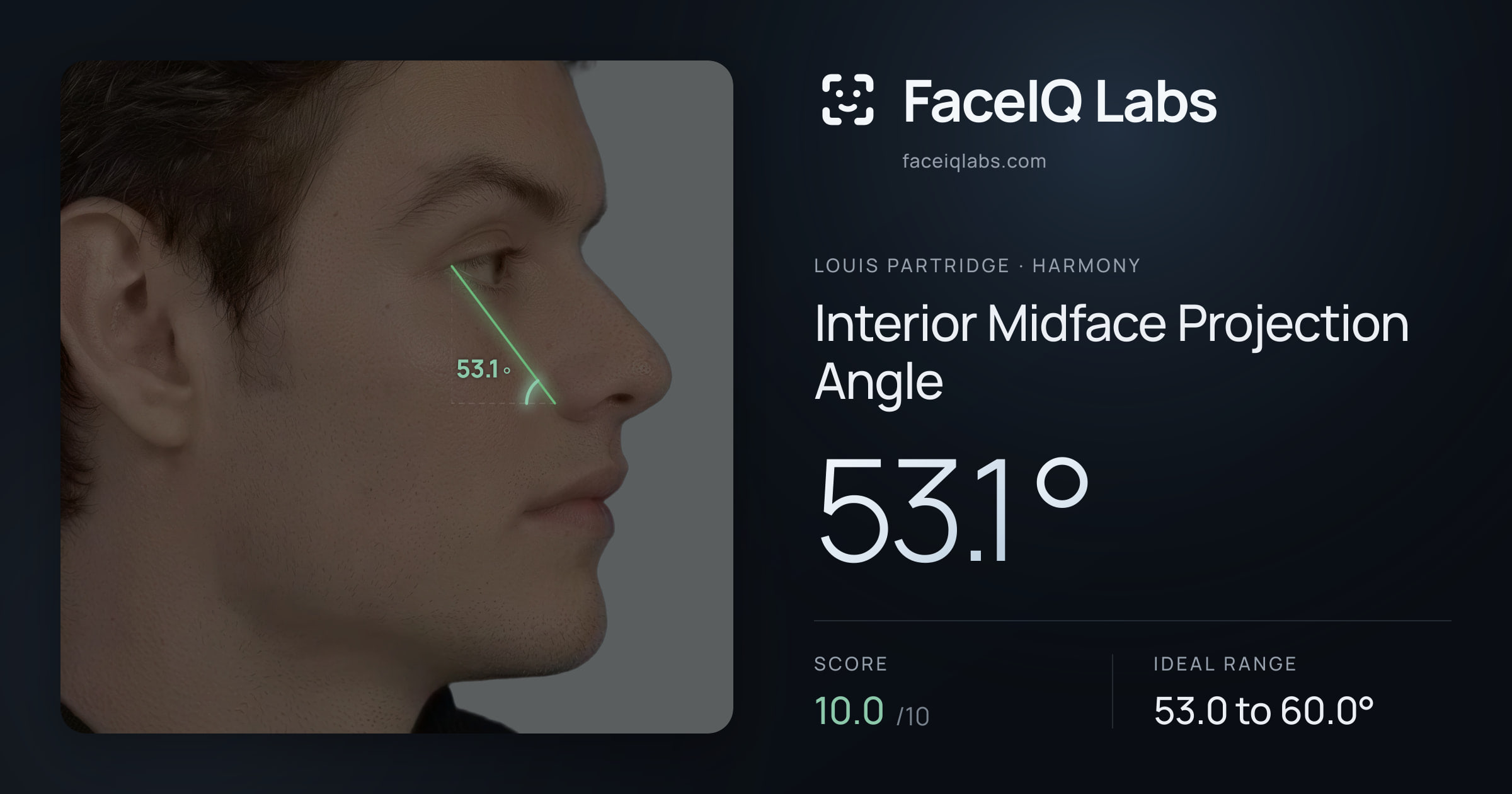 Louis Partridge Interior Midface Projection Angle: 53.1°, drawn on the photo