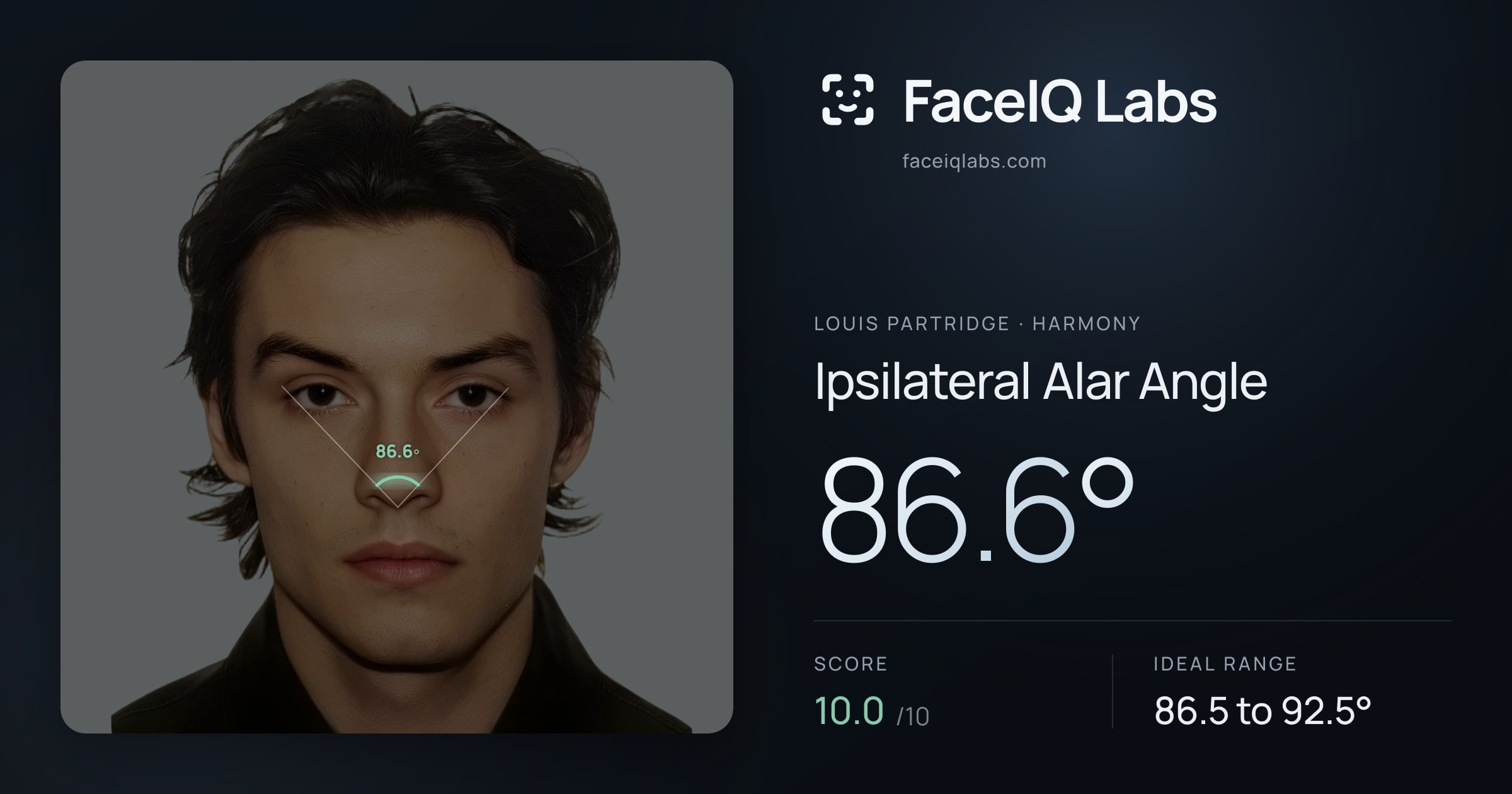 Louis Partridge Ipsilateral Alar Angle: 86.6°, drawn on the photo