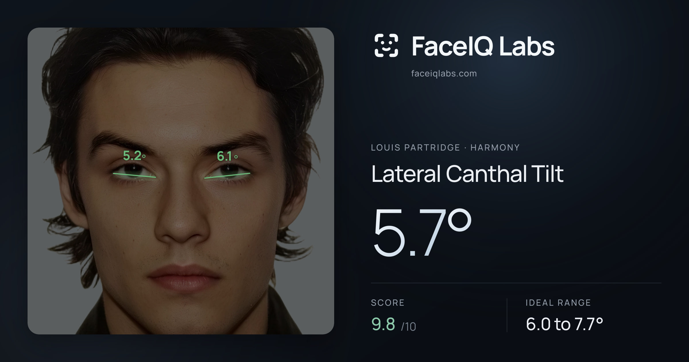 Louis Partridge Lateral Canthal Tilt: 5.7°, drawn on the photo
