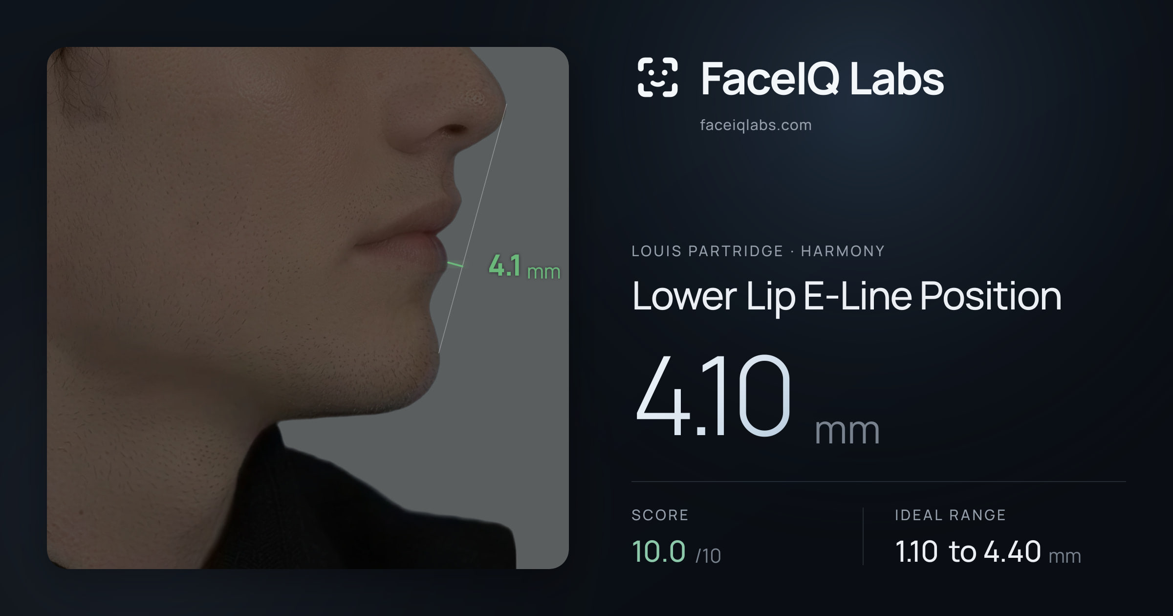 Louis Partridge Lower Lip E-Line Position: 4.10mm, drawn on the photo