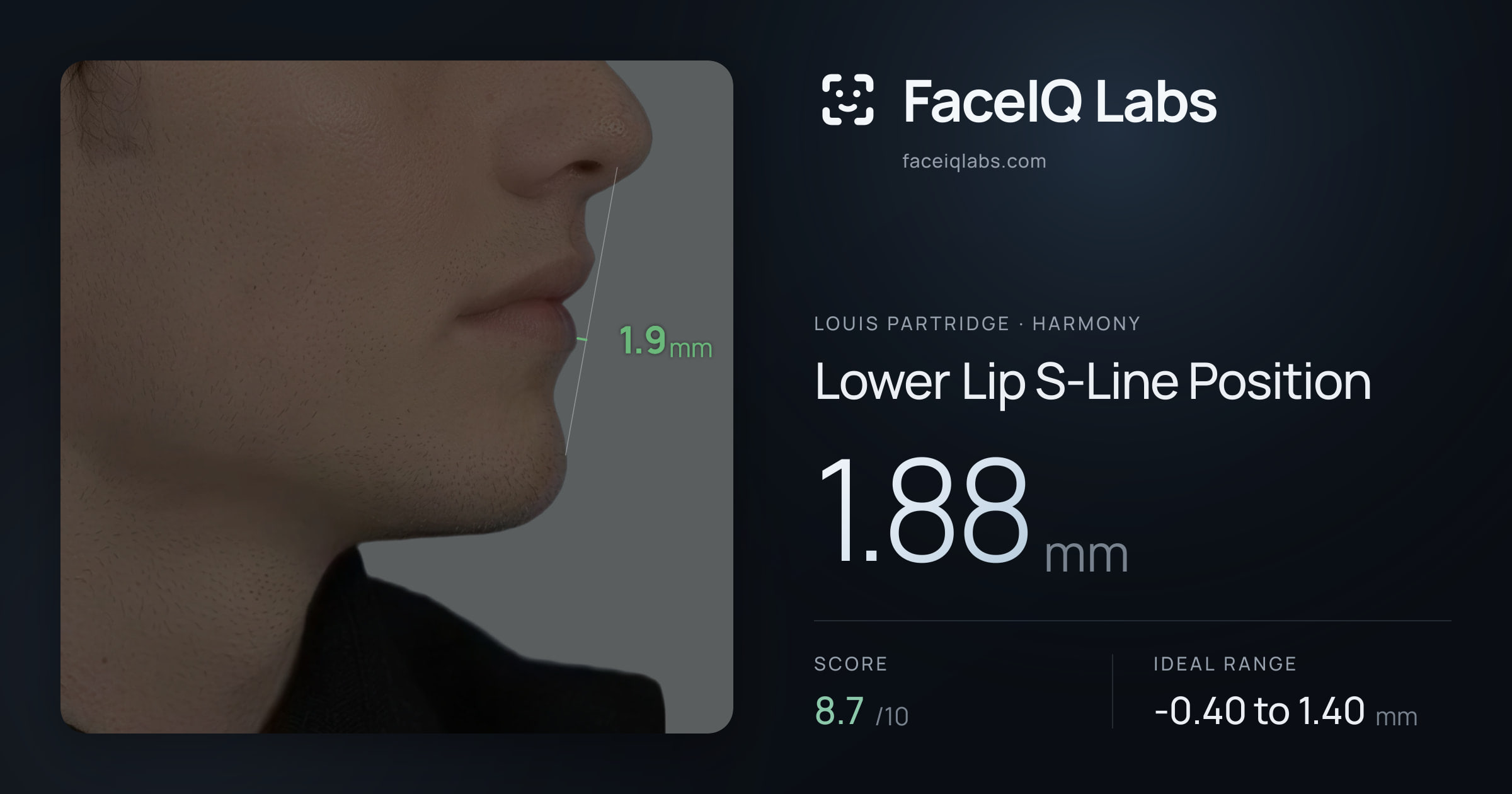Louis Partridge Lower Lip S-Line Position: 1.88mm, drawn on the photo