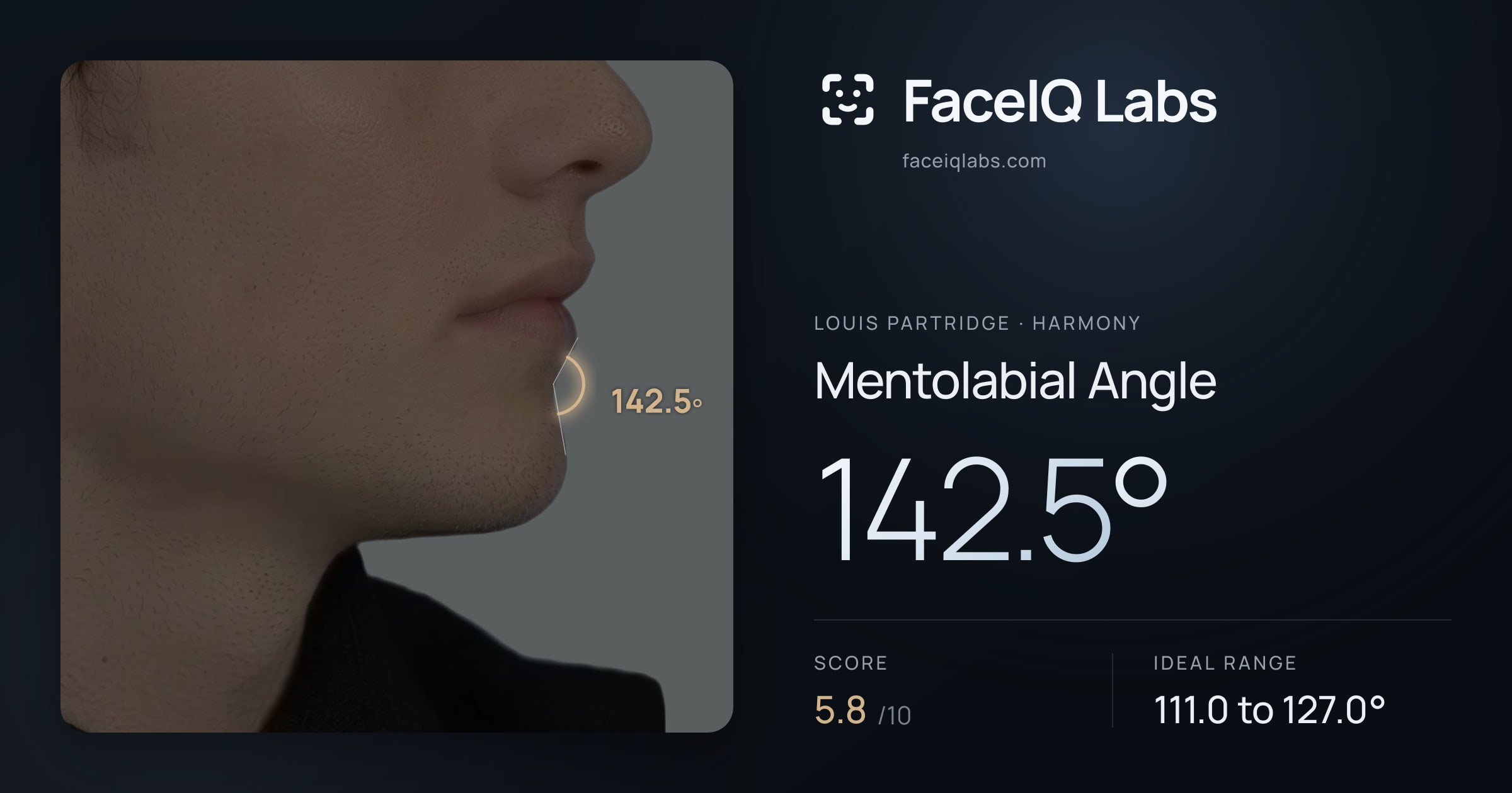 Louis Partridge Mentolabial Angle: 142.5°, drawn on the photo