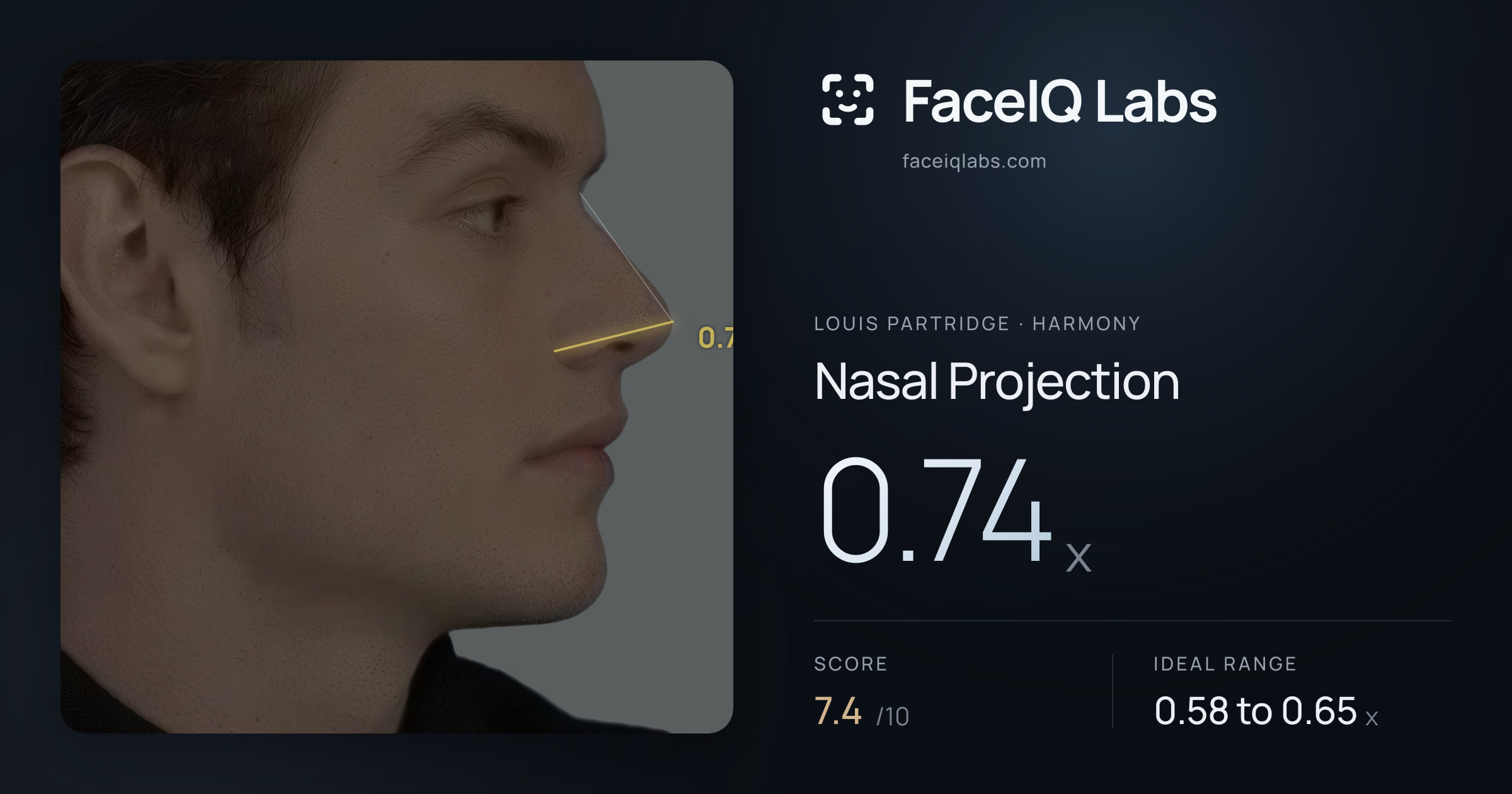 Louis Partridge Nasal Projection: 0.74x, drawn on the photo