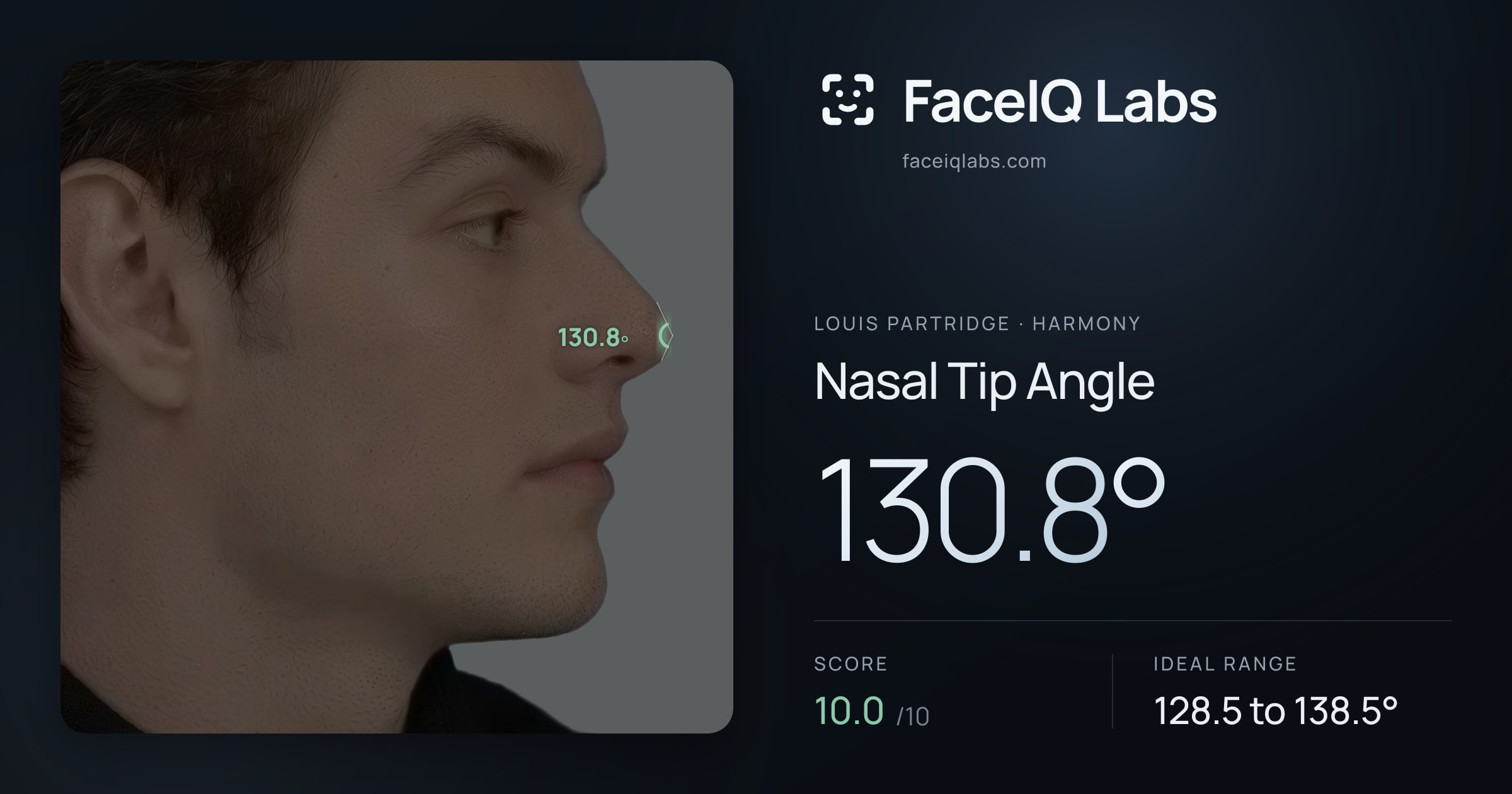 Louis Partridge Nasal Tip Angle: 130.8°, drawn on the photo
