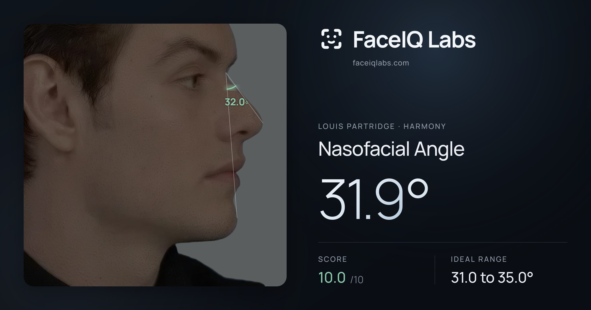 Louis Partridge Nasofacial Angle: 31.9°, drawn on the photo